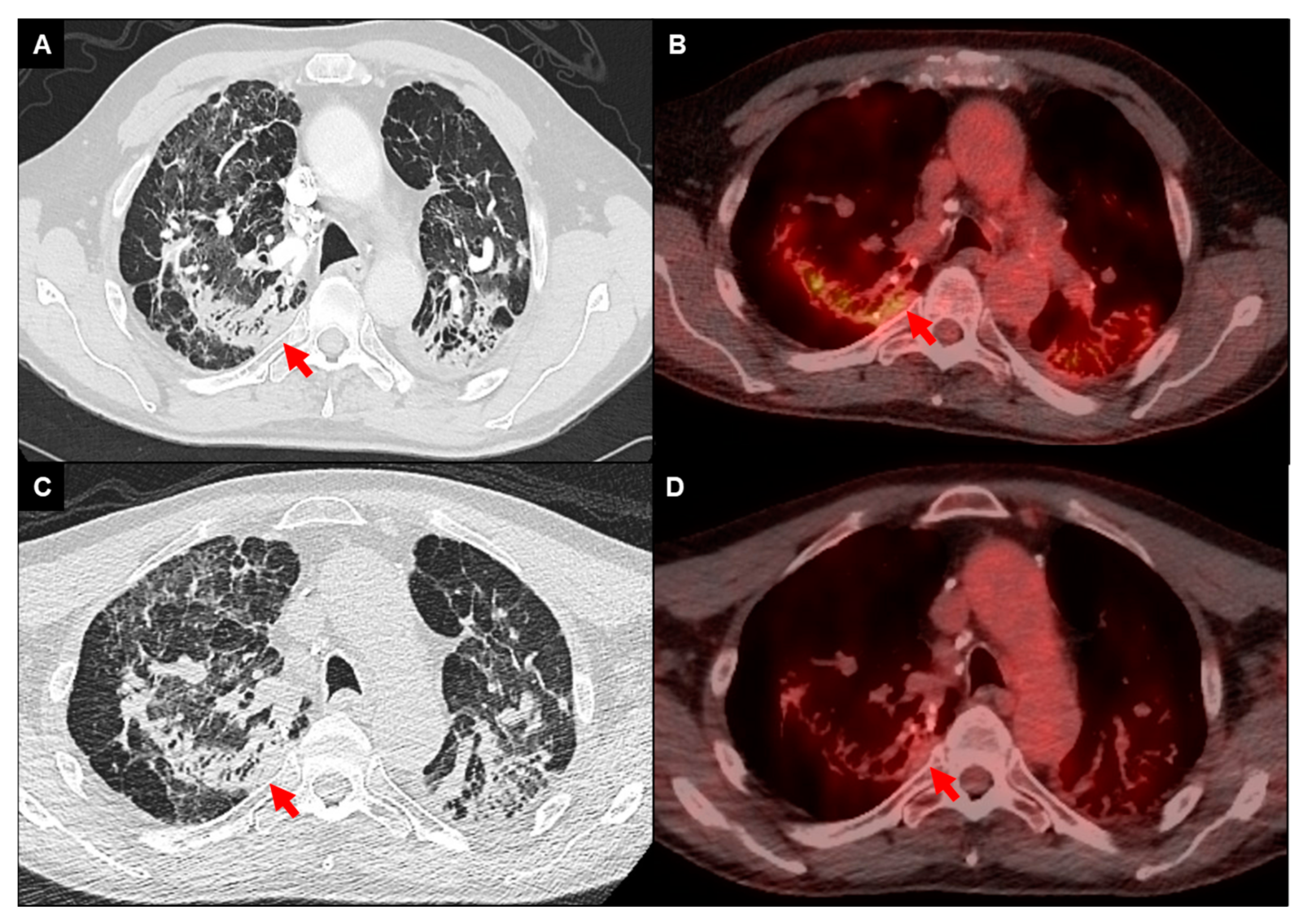 Jcm 13 00241 g003 Jcm 13 00241 g003