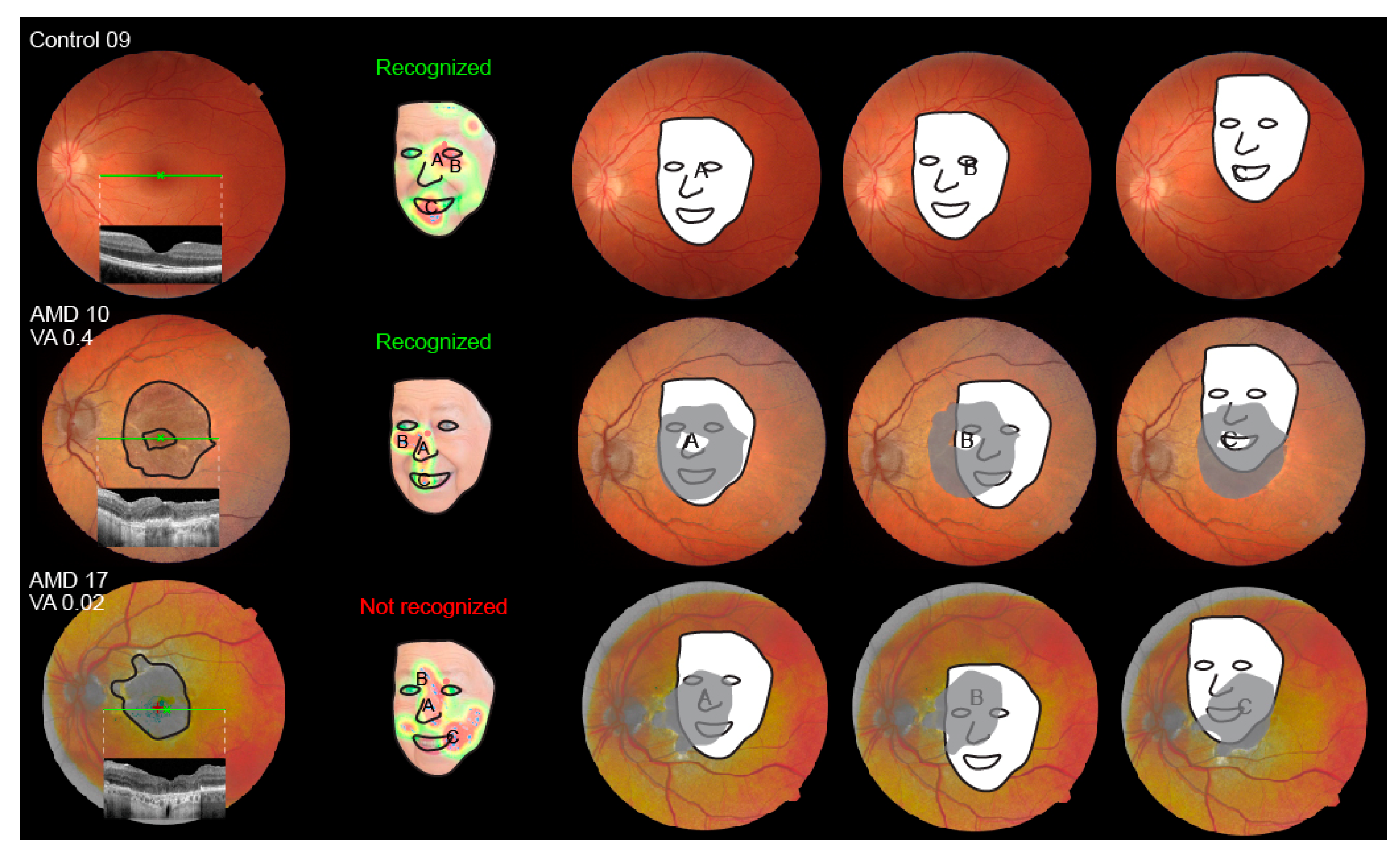 Jcm 13 00636 g004 Jcm 13 00636 g004
