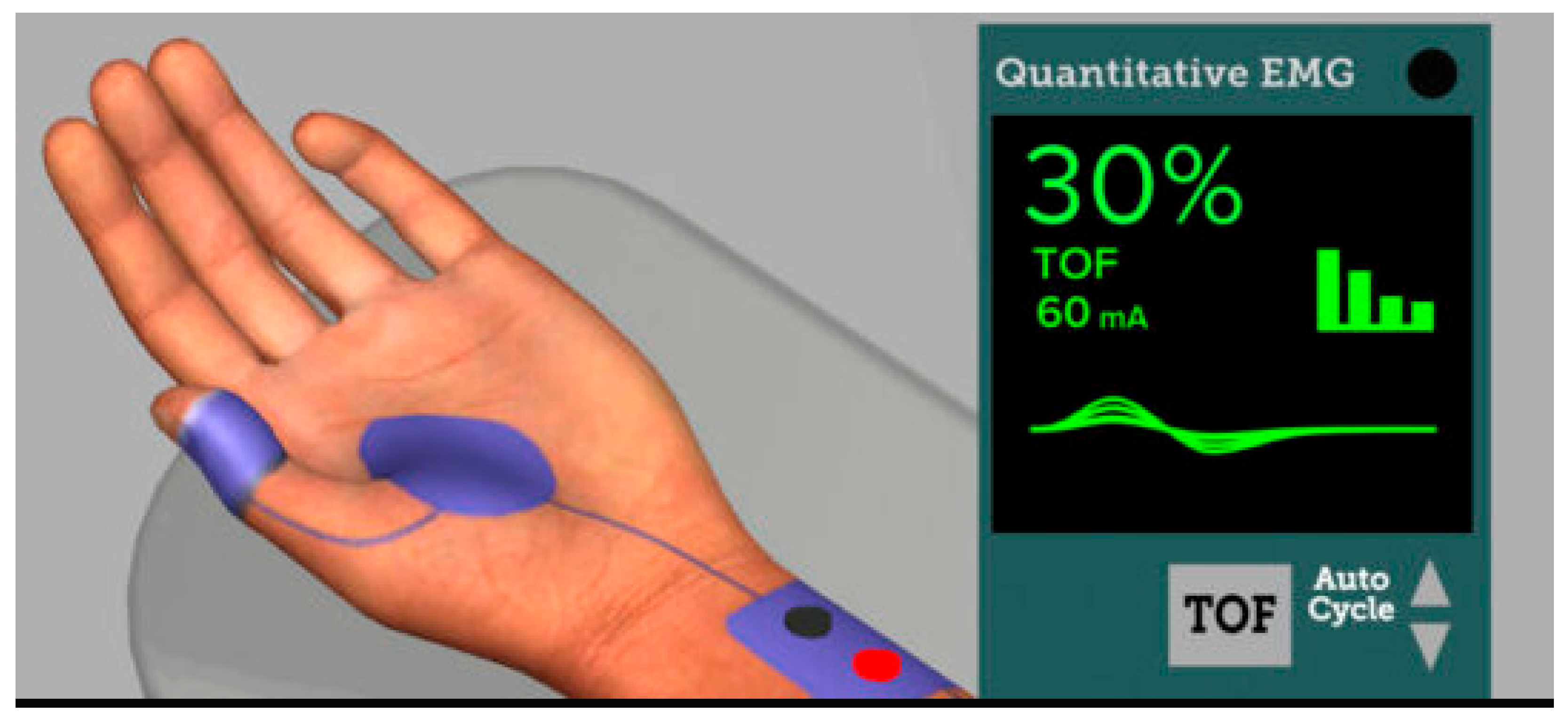 Jcm 13 00861 g003 Jcm 13 00861 g003