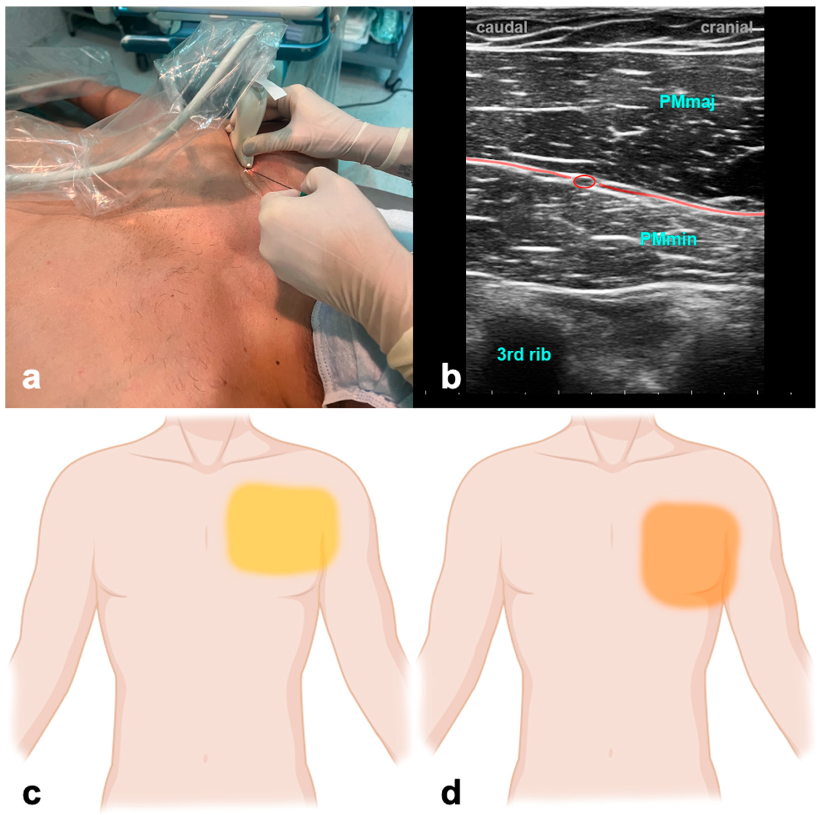Jcm 13 01104 g001 Jcm 13 01104 g001