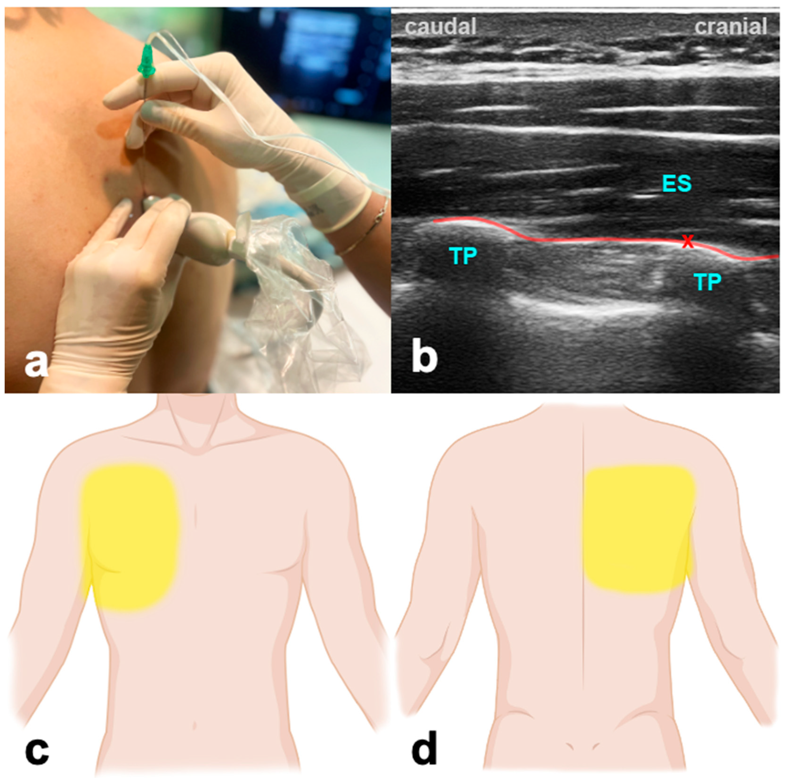 Jcm 13 01104 g003 Jcm 13 01104 g003