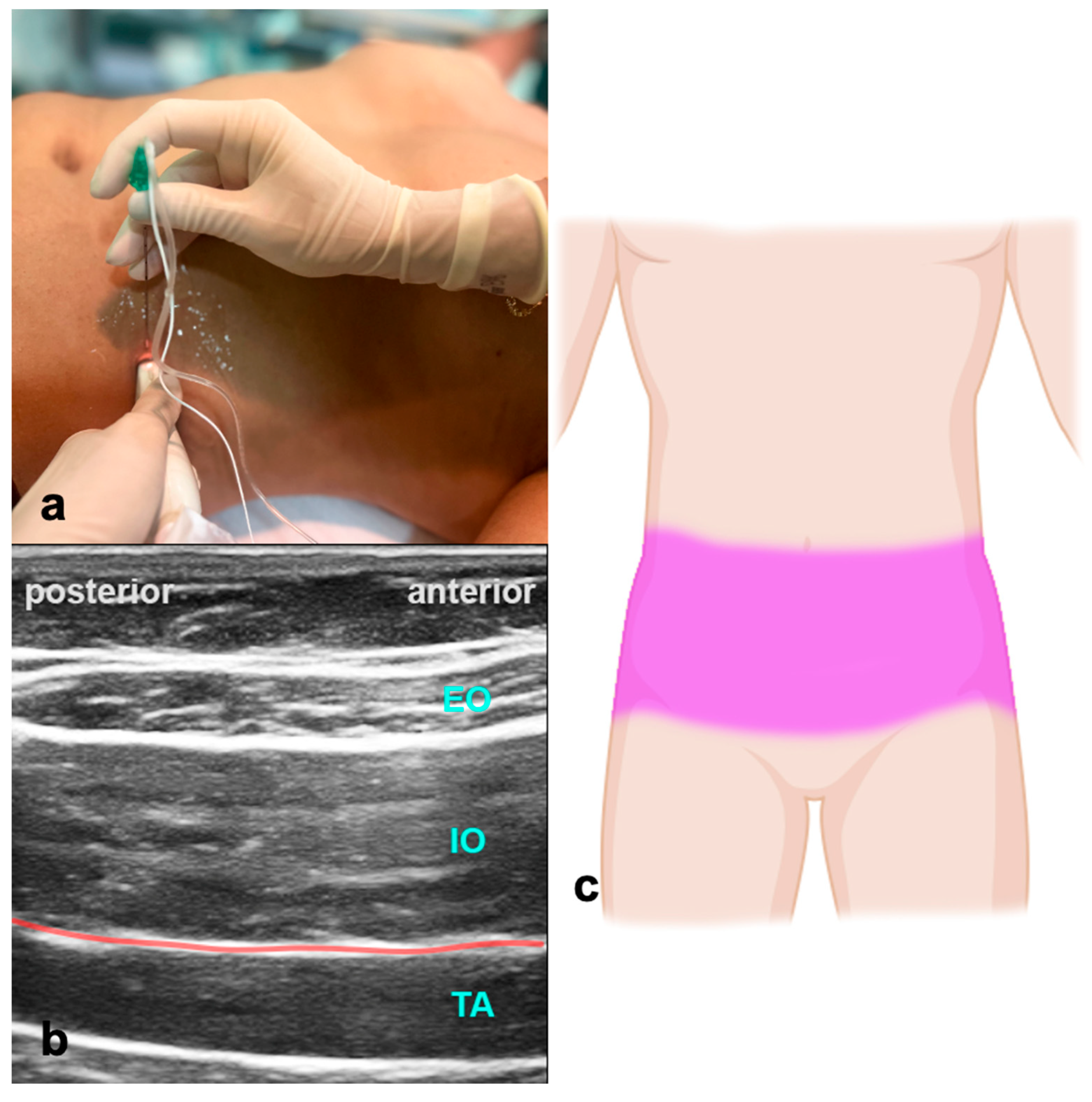 Jcm 13 01104 g005 Jcm 13 01104 g005