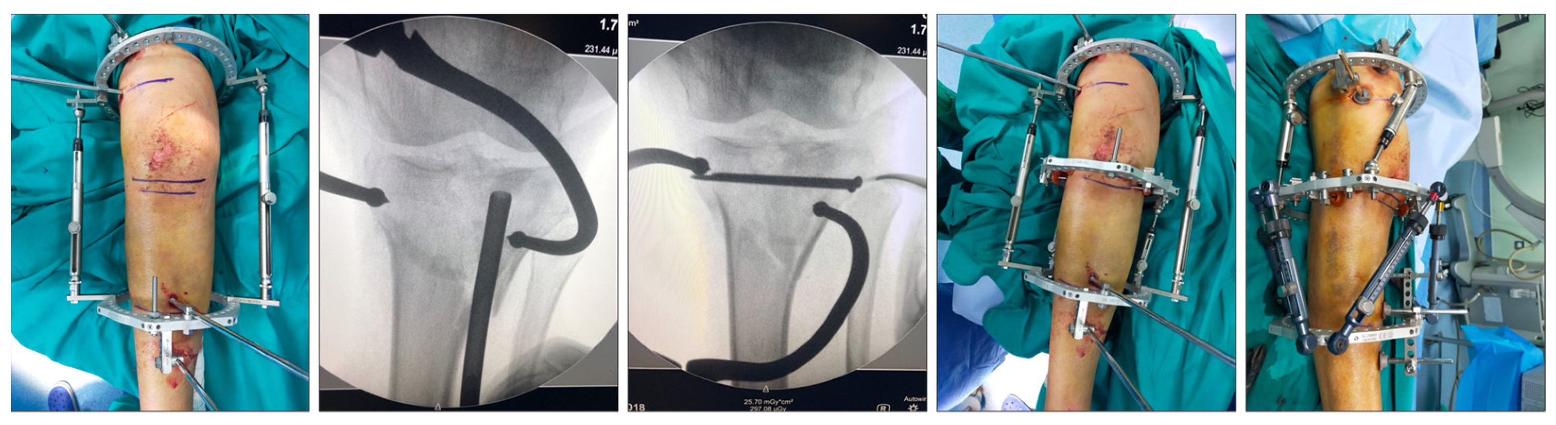 Jcm 13 01249 g002 Jcm 13 01249 g002