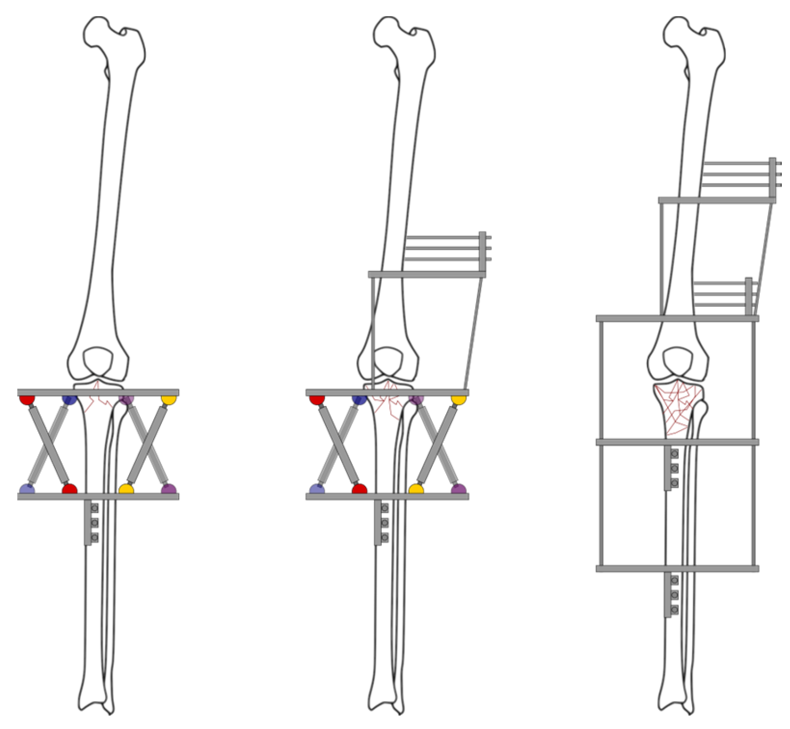 Jcm 13 01249 g003 Jcm 13 01249 g003