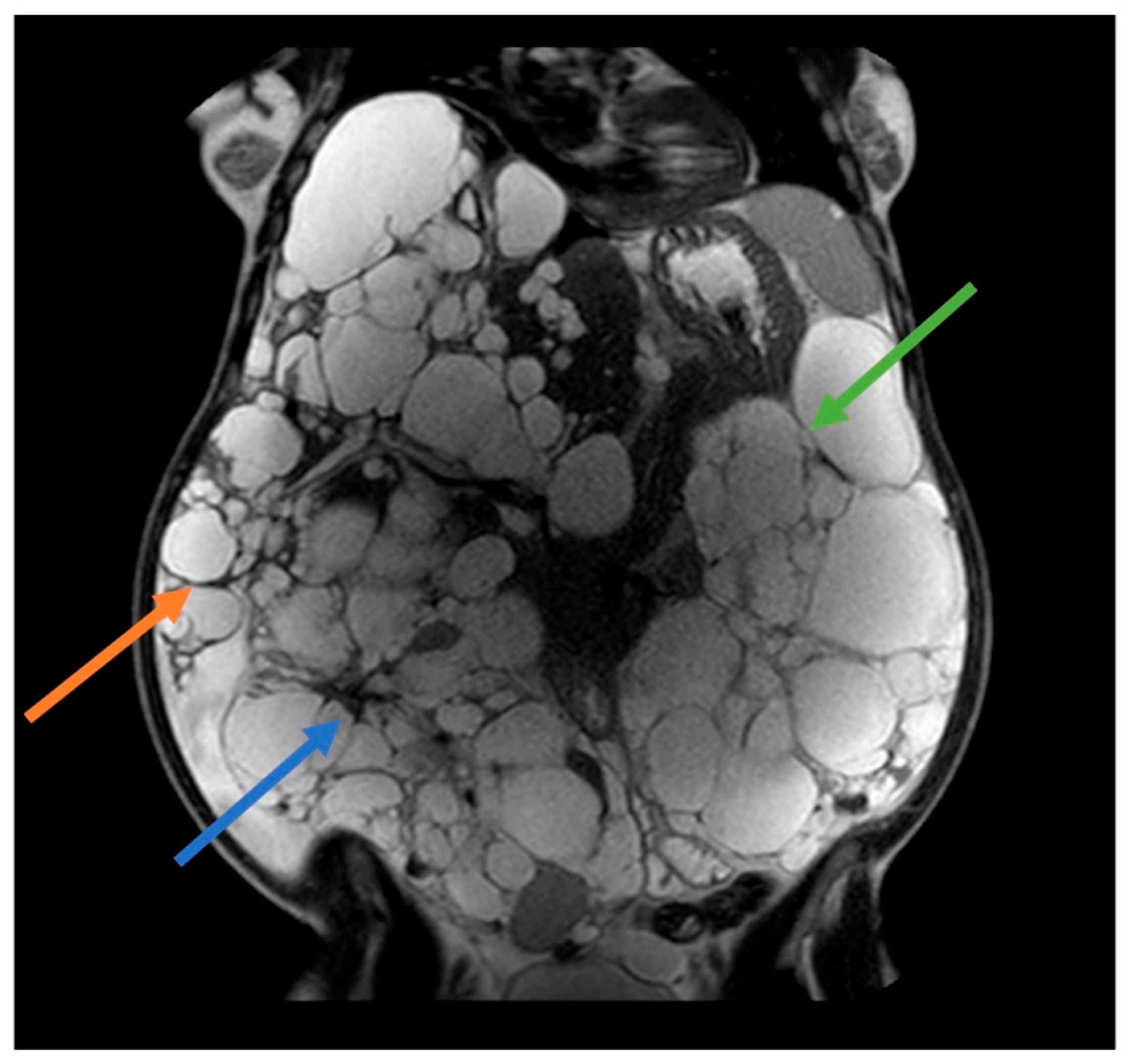 Jcm 13 01257 g001 Jcm 13 01257 g001