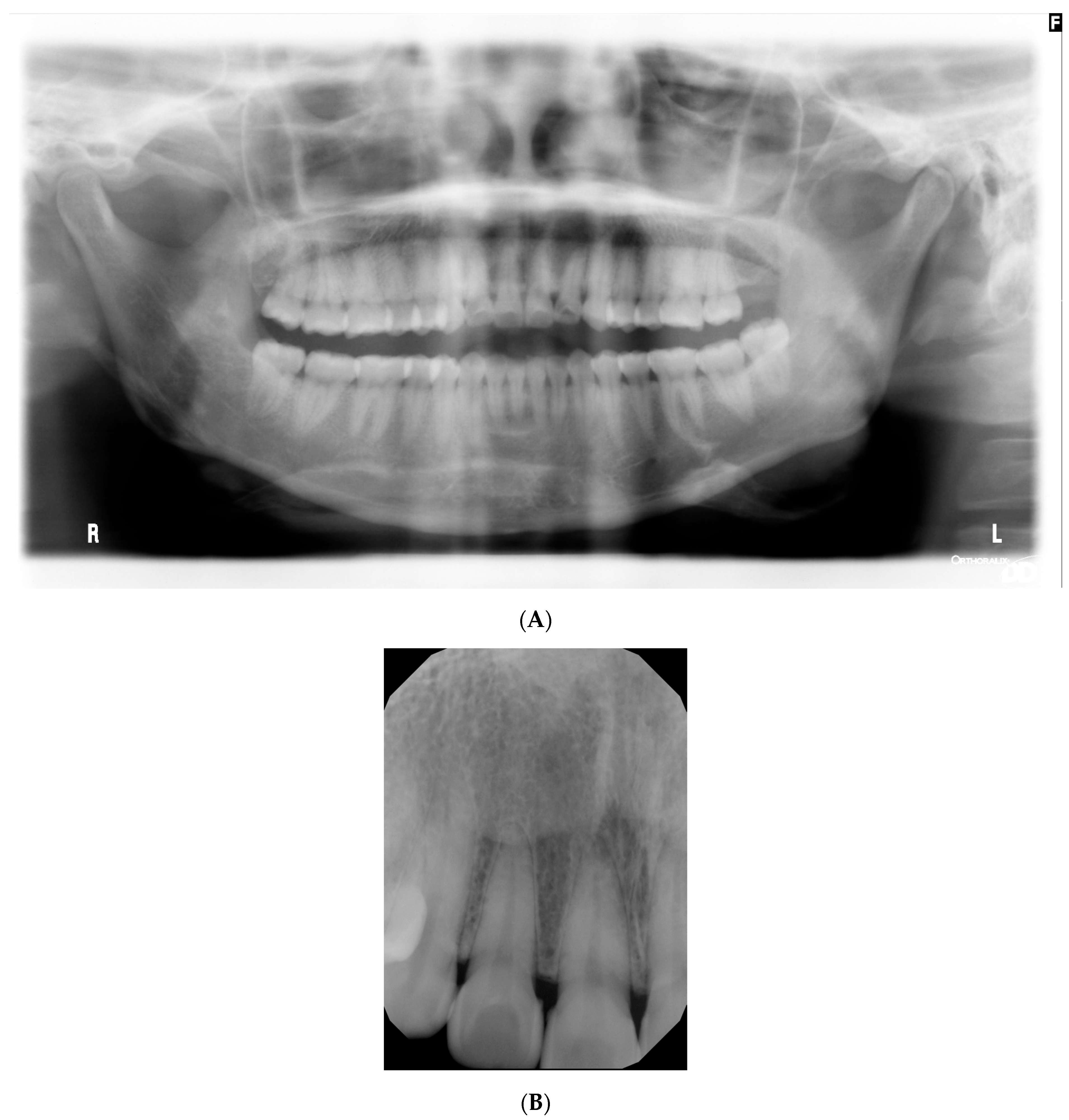 Jcm 13 01285 g002 Jcm 13 01285 g002