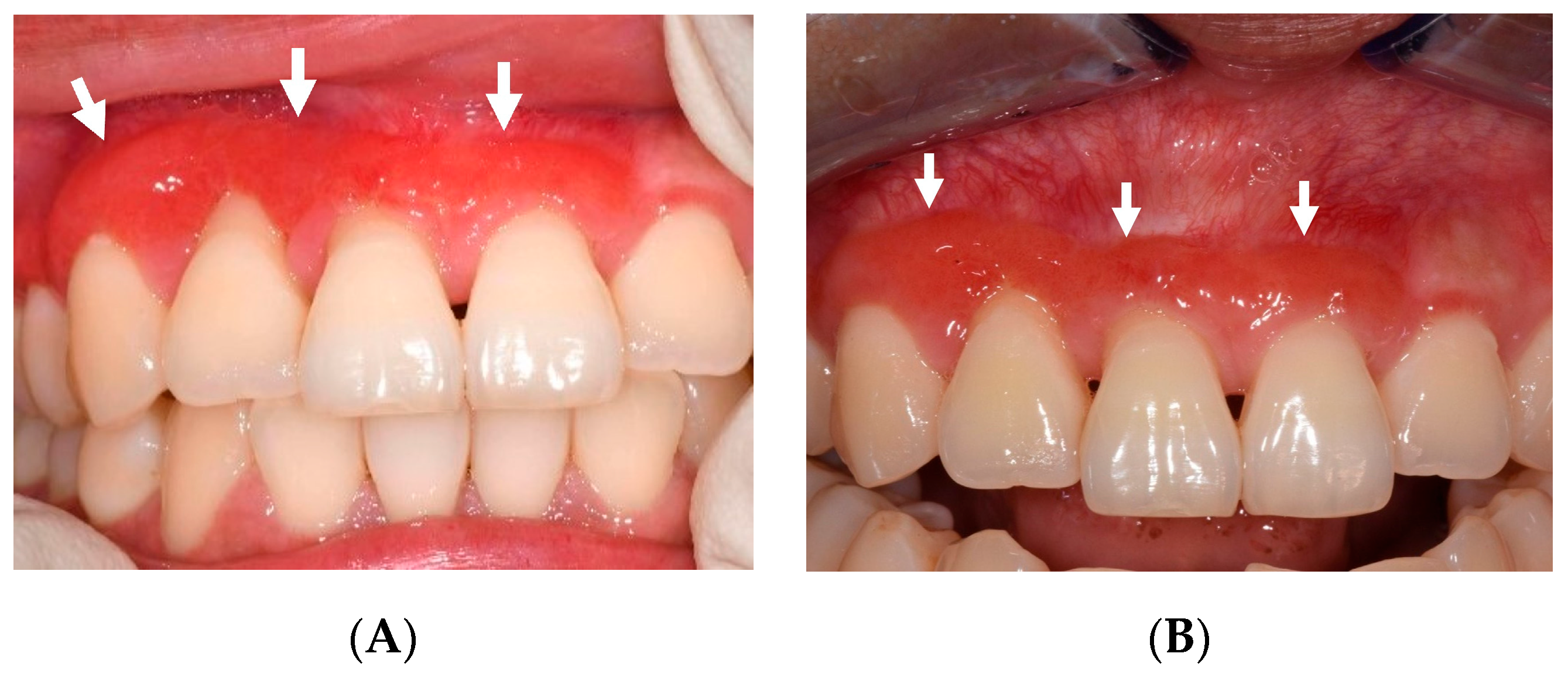 Jcm 13 01285 g004 Jcm 13 01285 g004
