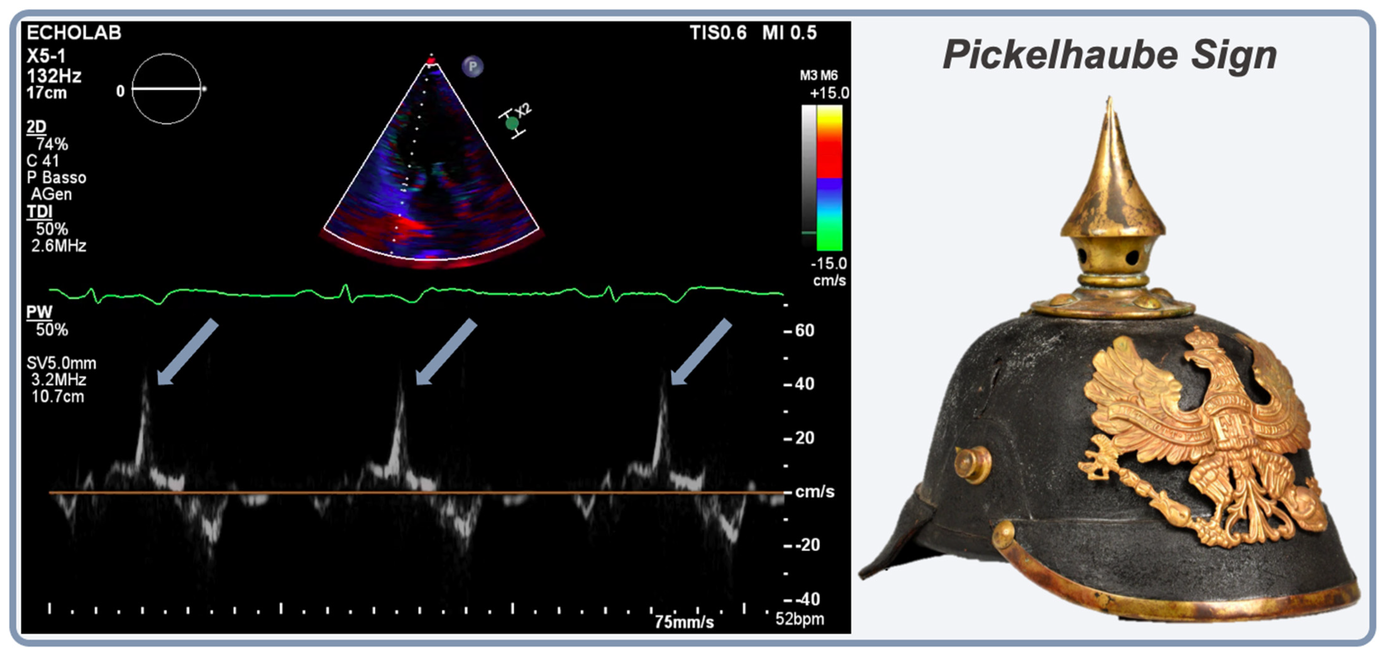 Jcm 13 01350 g003 Jcm 13 01350 g003