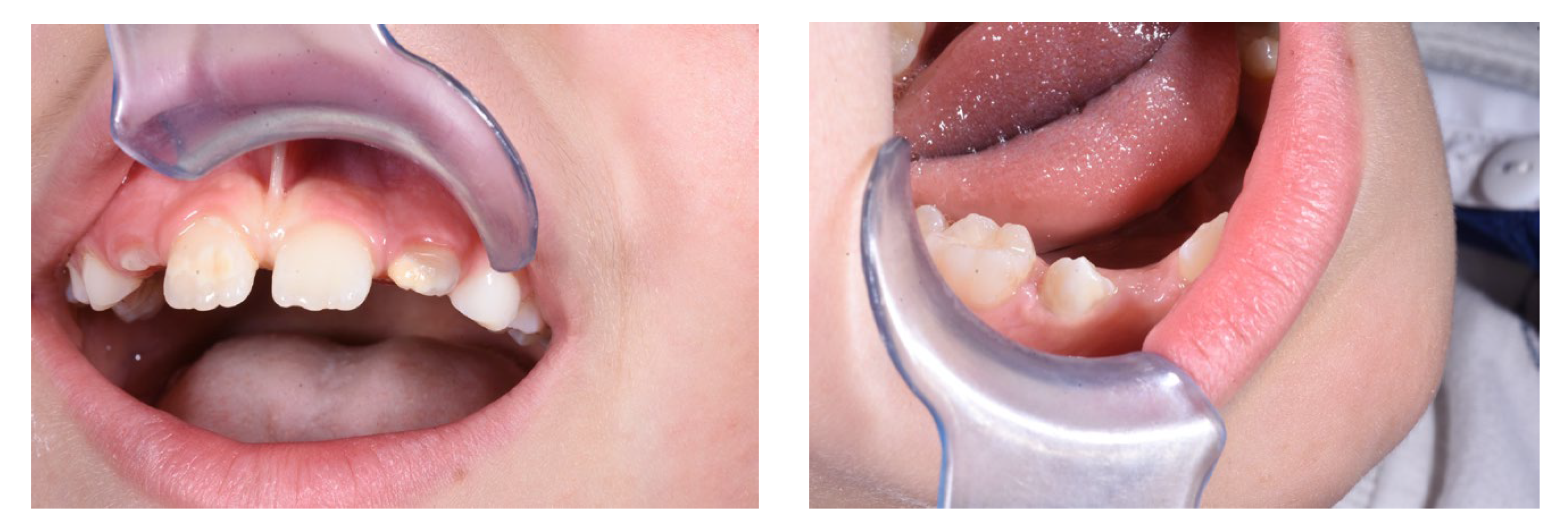 Jcm 13 01382 g005 Jcm 13 01382 g005