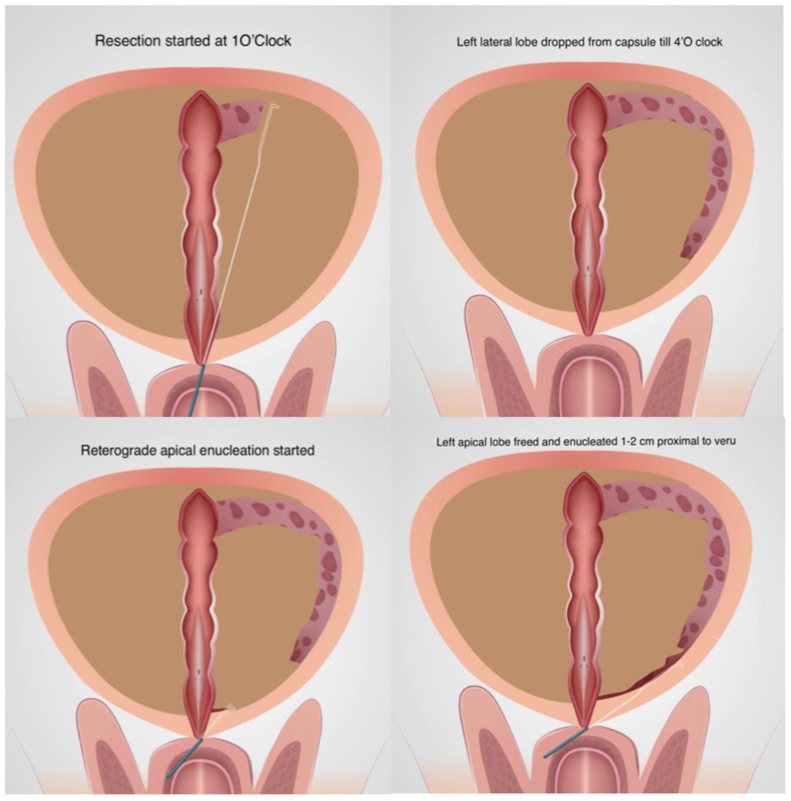 Jcm 13 01455 g001 Jcm 13 01455 g001