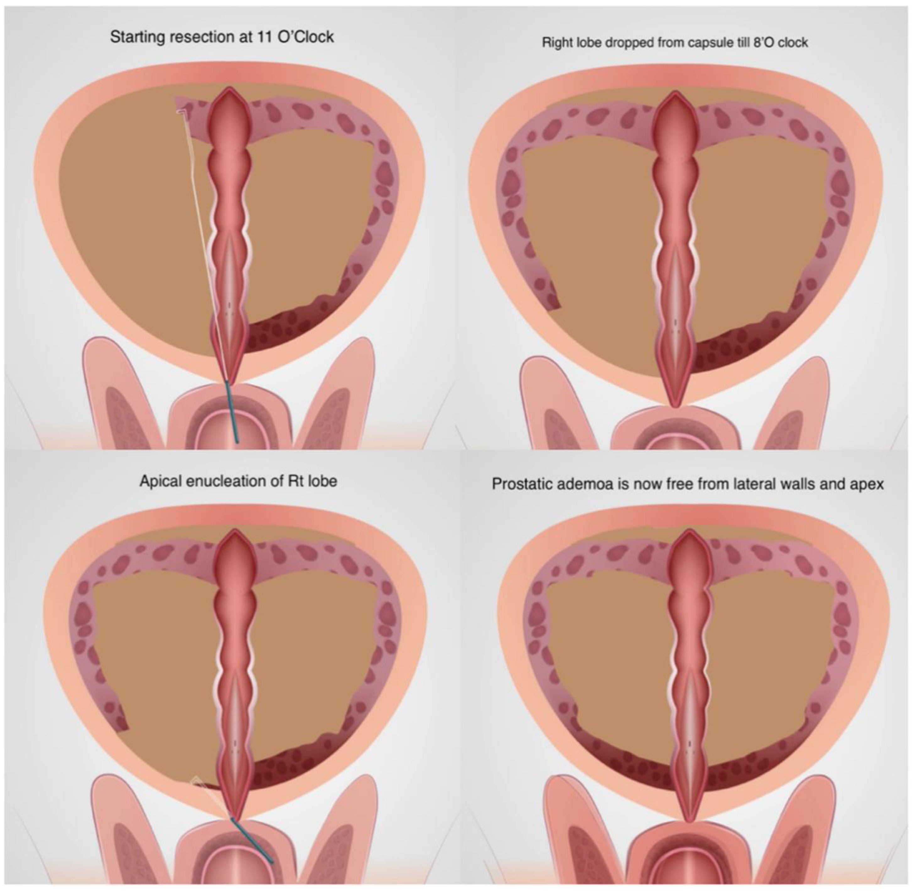 Jcm 13 01455 g002 Jcm 13 01455 g002
