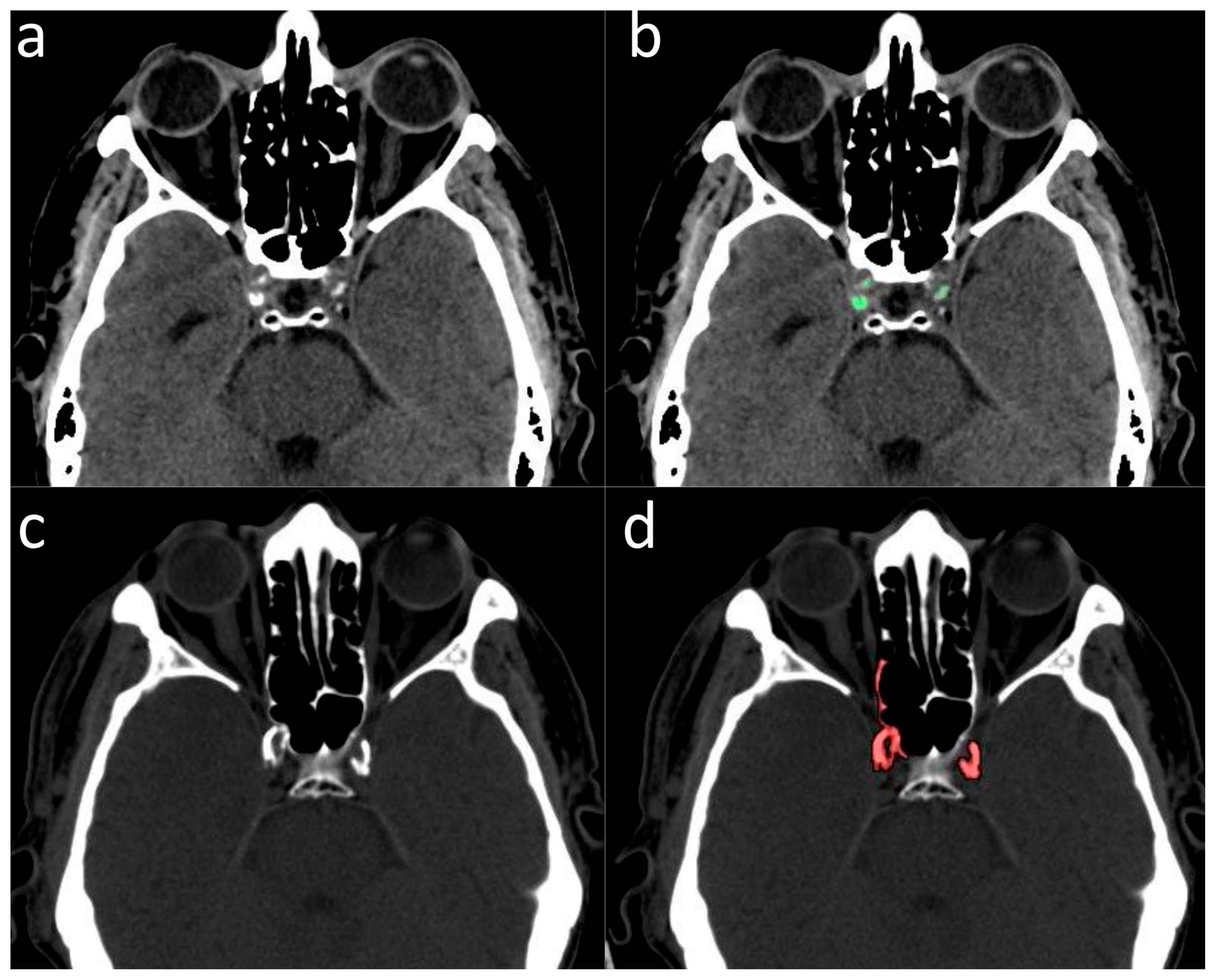 Jcm 13 01512 g001 Jcm 13 01512 g001