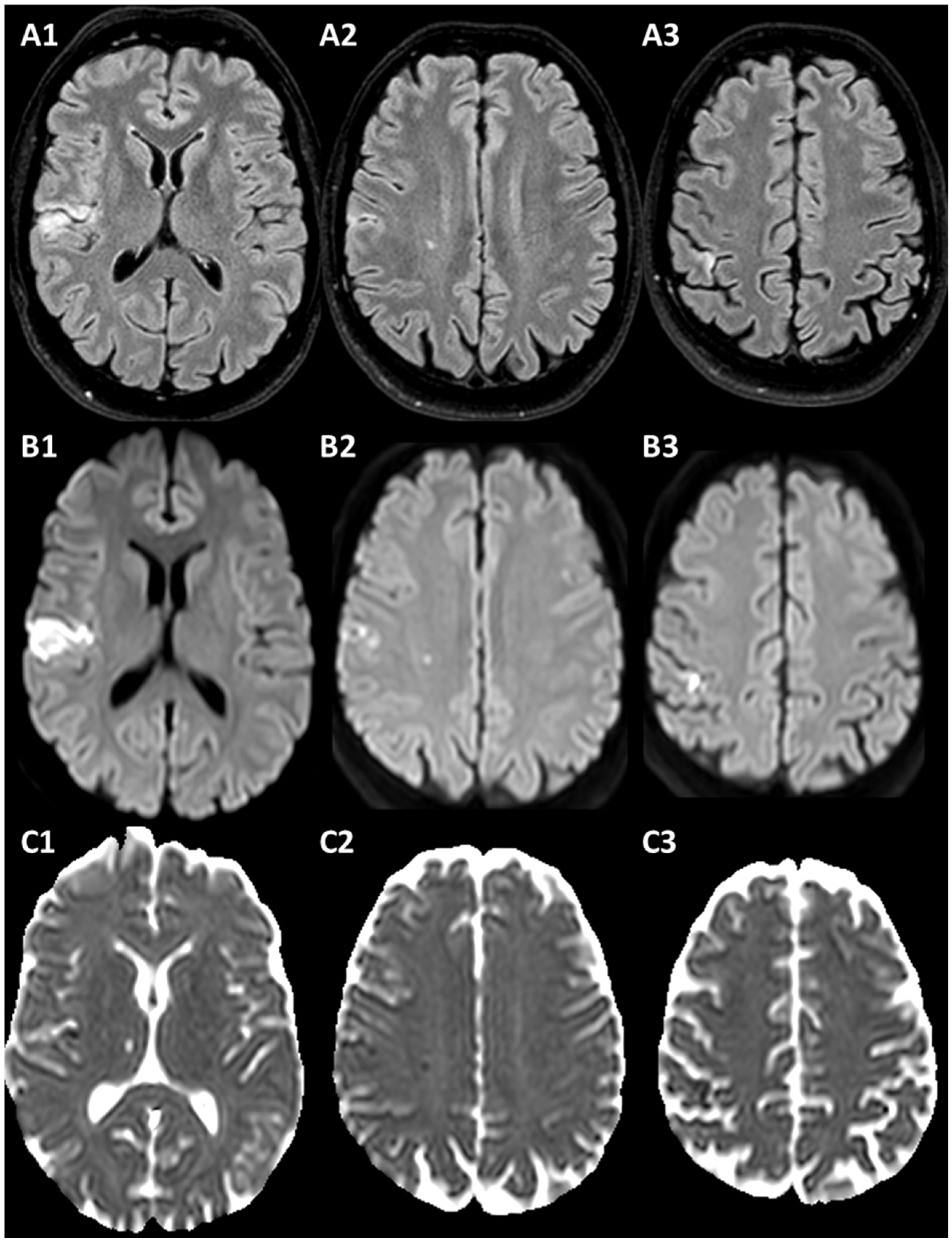 Jcm 13 01696 g002 Jcm 13 01696 g002