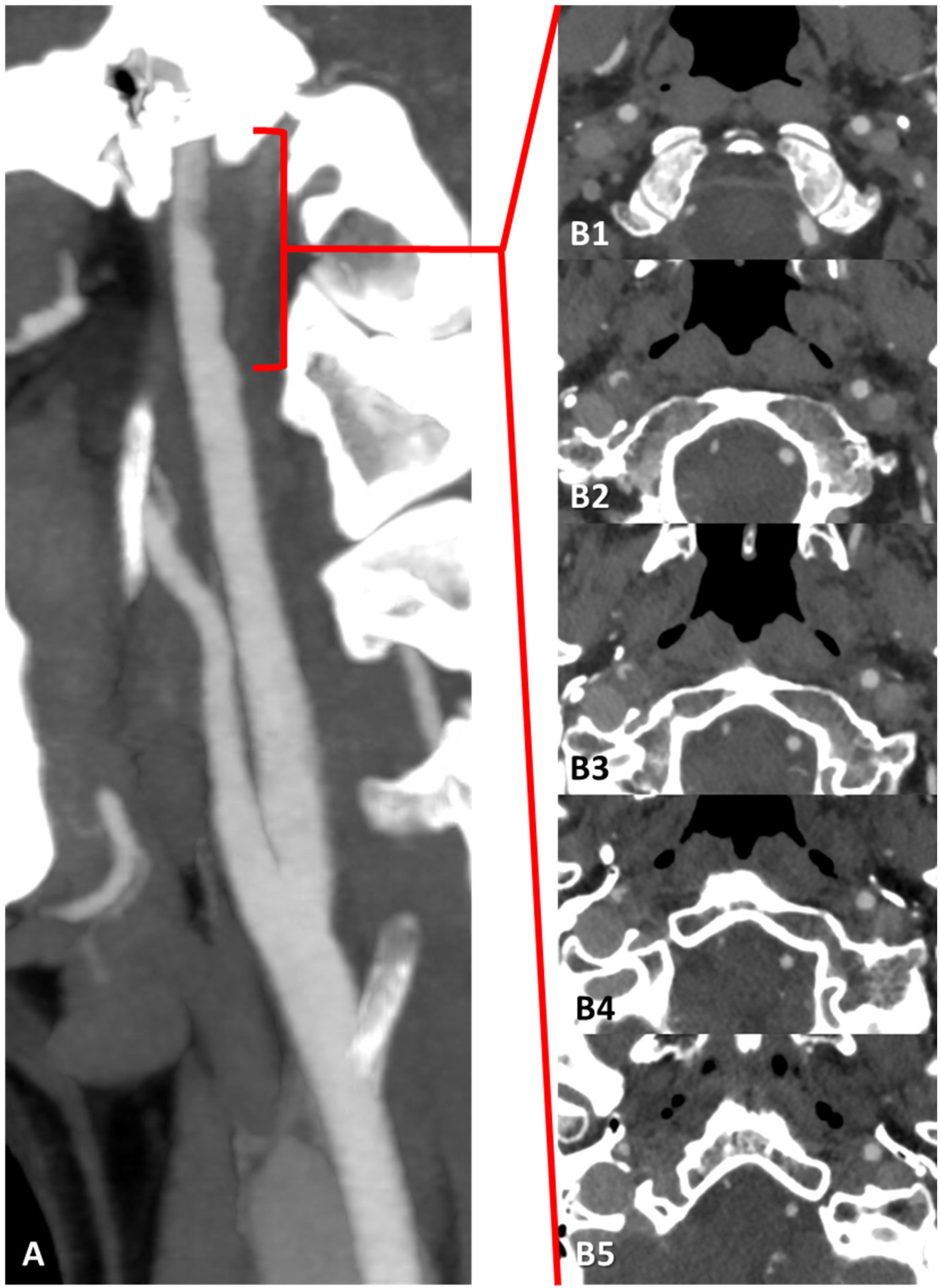 Jcm 13 01696 g003 Jcm 13 01696 g003