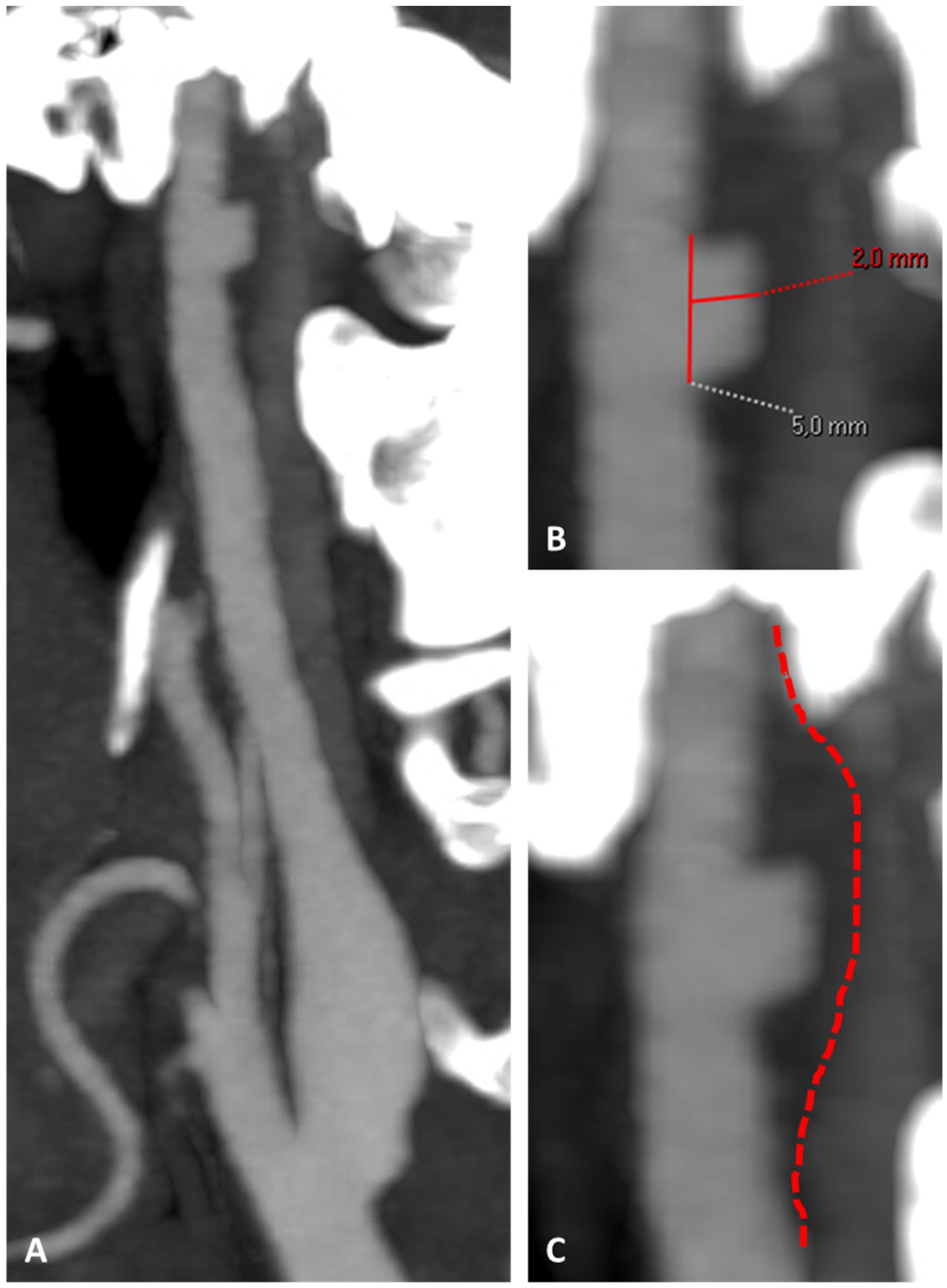 Jcm 13 01696 g006 Jcm 13 01696 g006