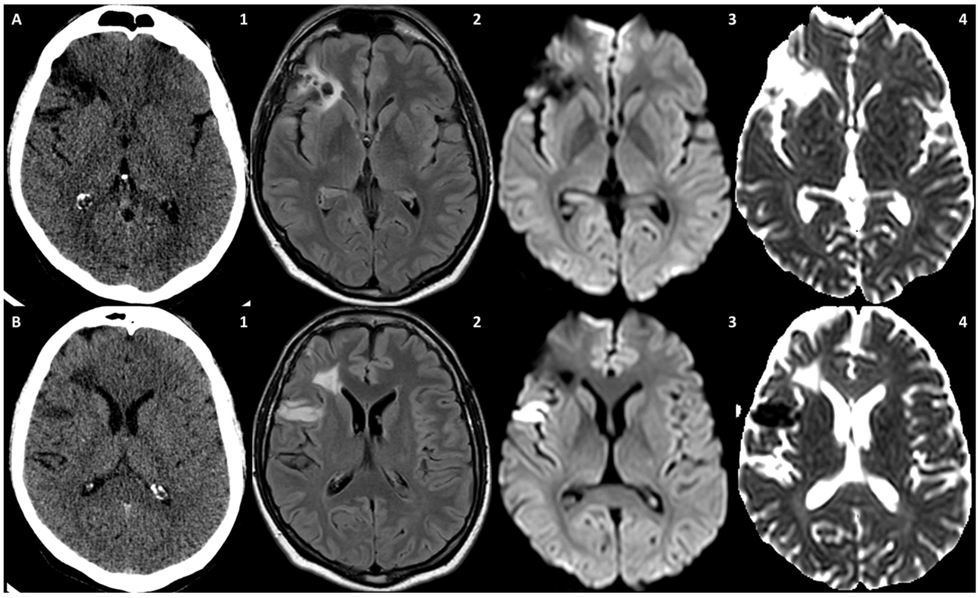 Jcm 13 01696 g010 Jcm 13 01696 g010