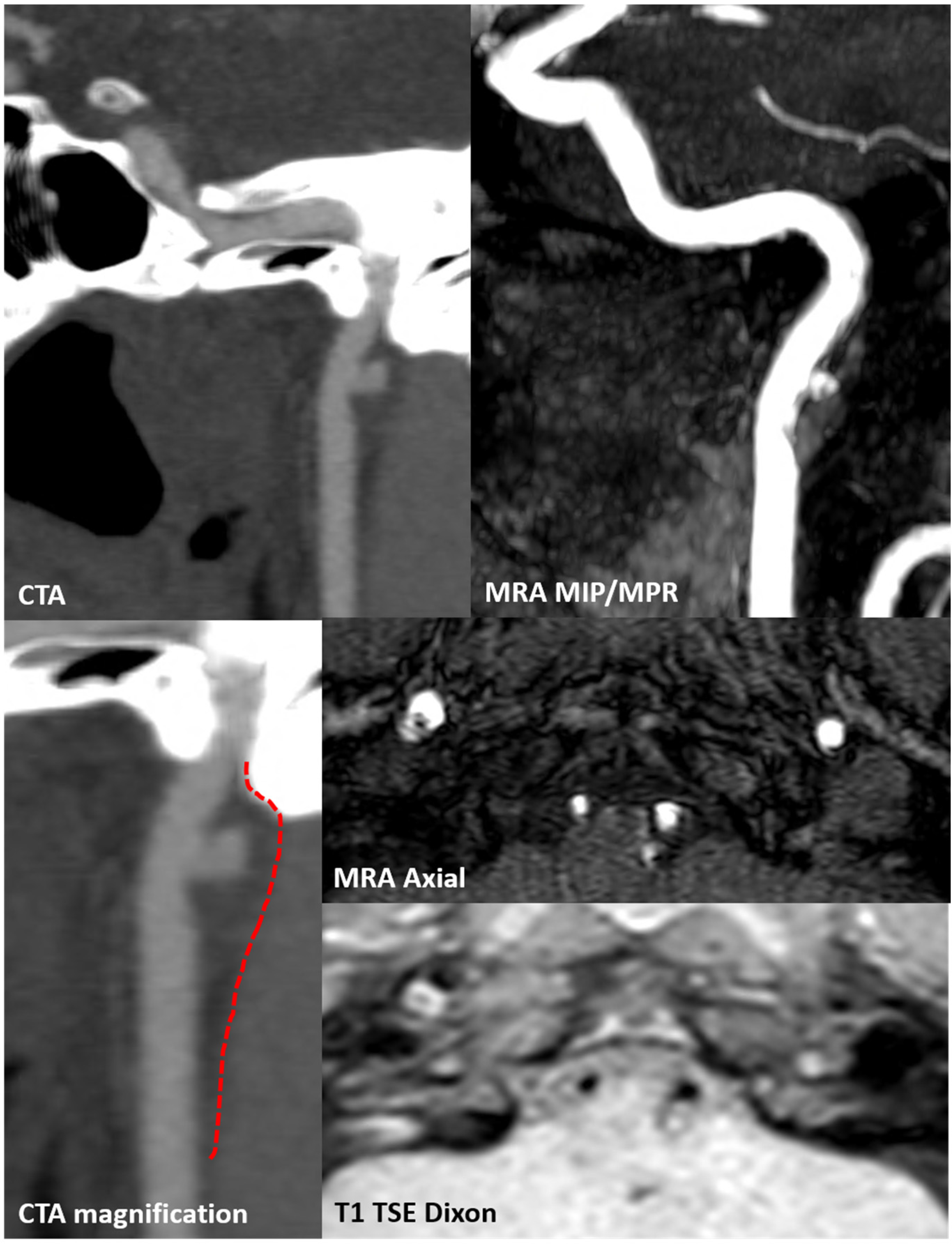 Jcm 13 01696 g015 Jcm 13 01696 g015