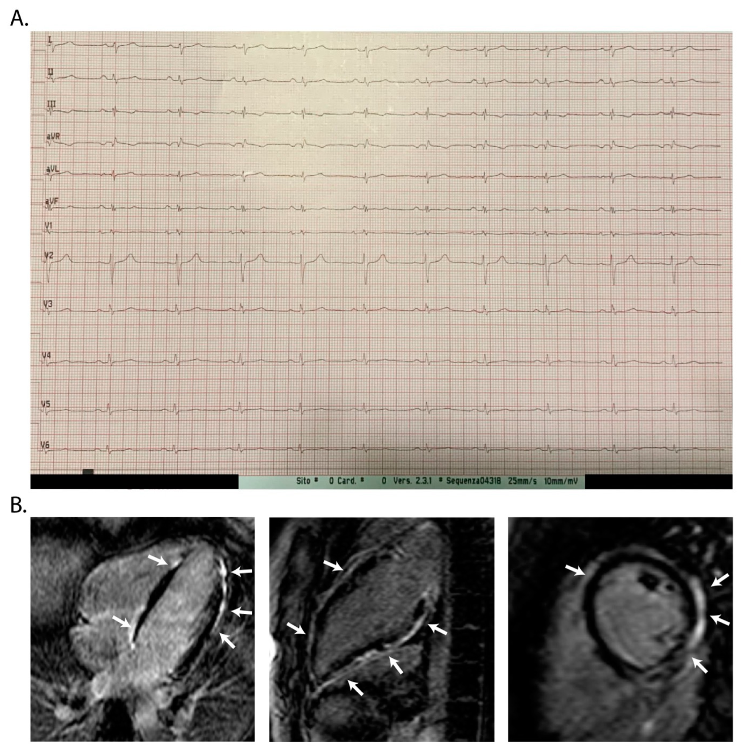 Jcm 13 01835 g005