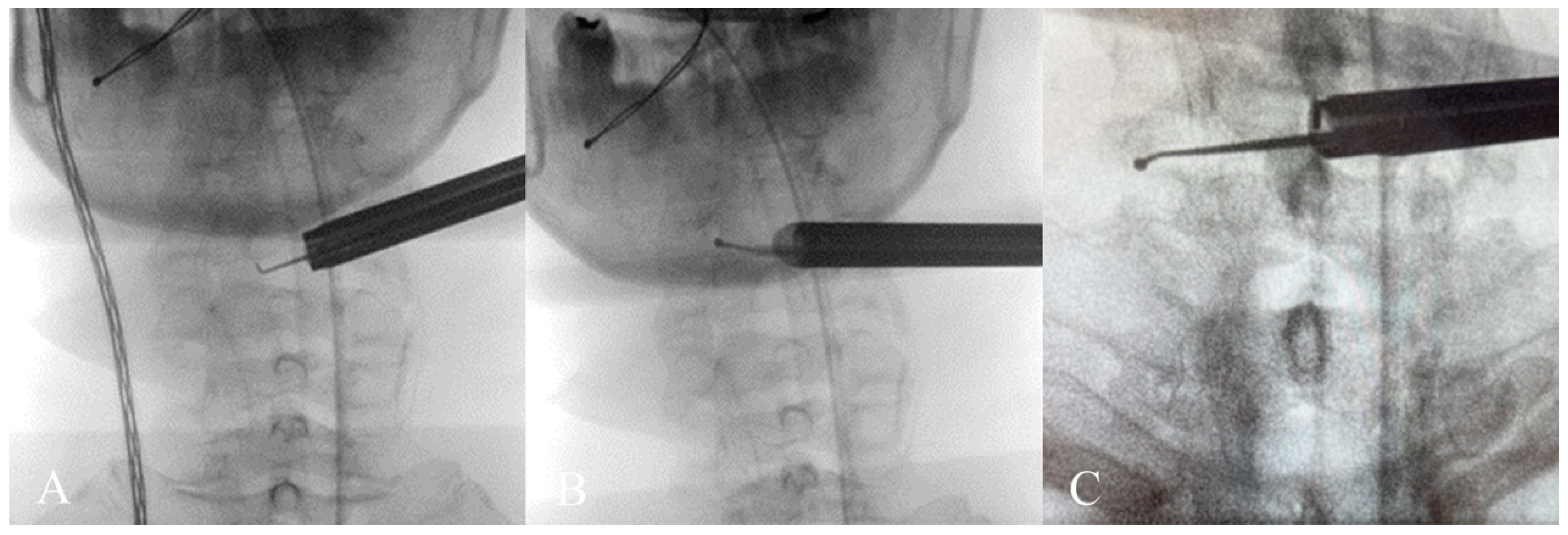 Jcm 13 01910 g011 Jcm 13 01910 g011