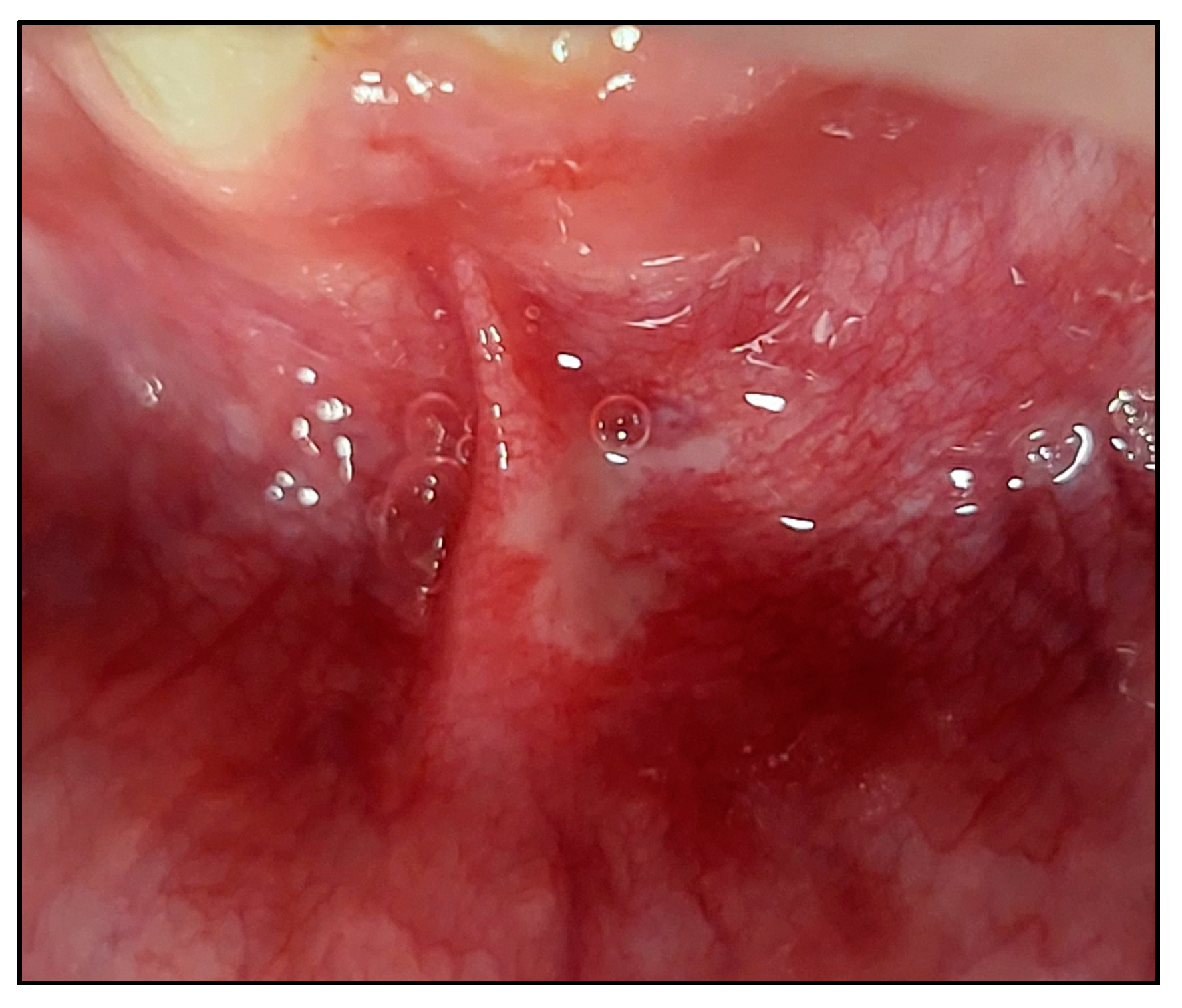Jcm 13 02007 g006 Jcm 13 02007 g006