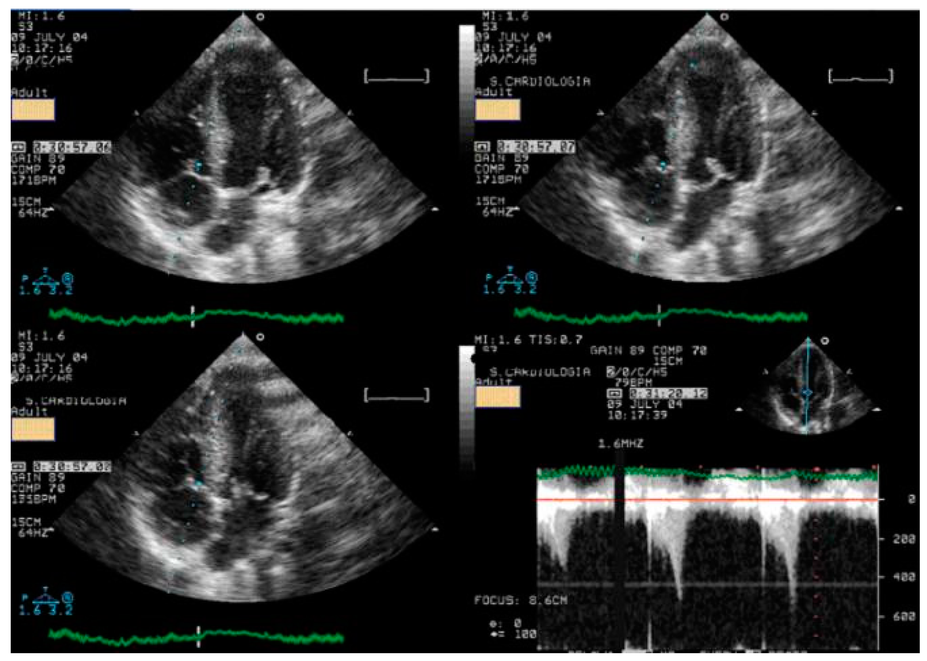 Jcm 13 02191 g002 Jcm 13 02191 g002