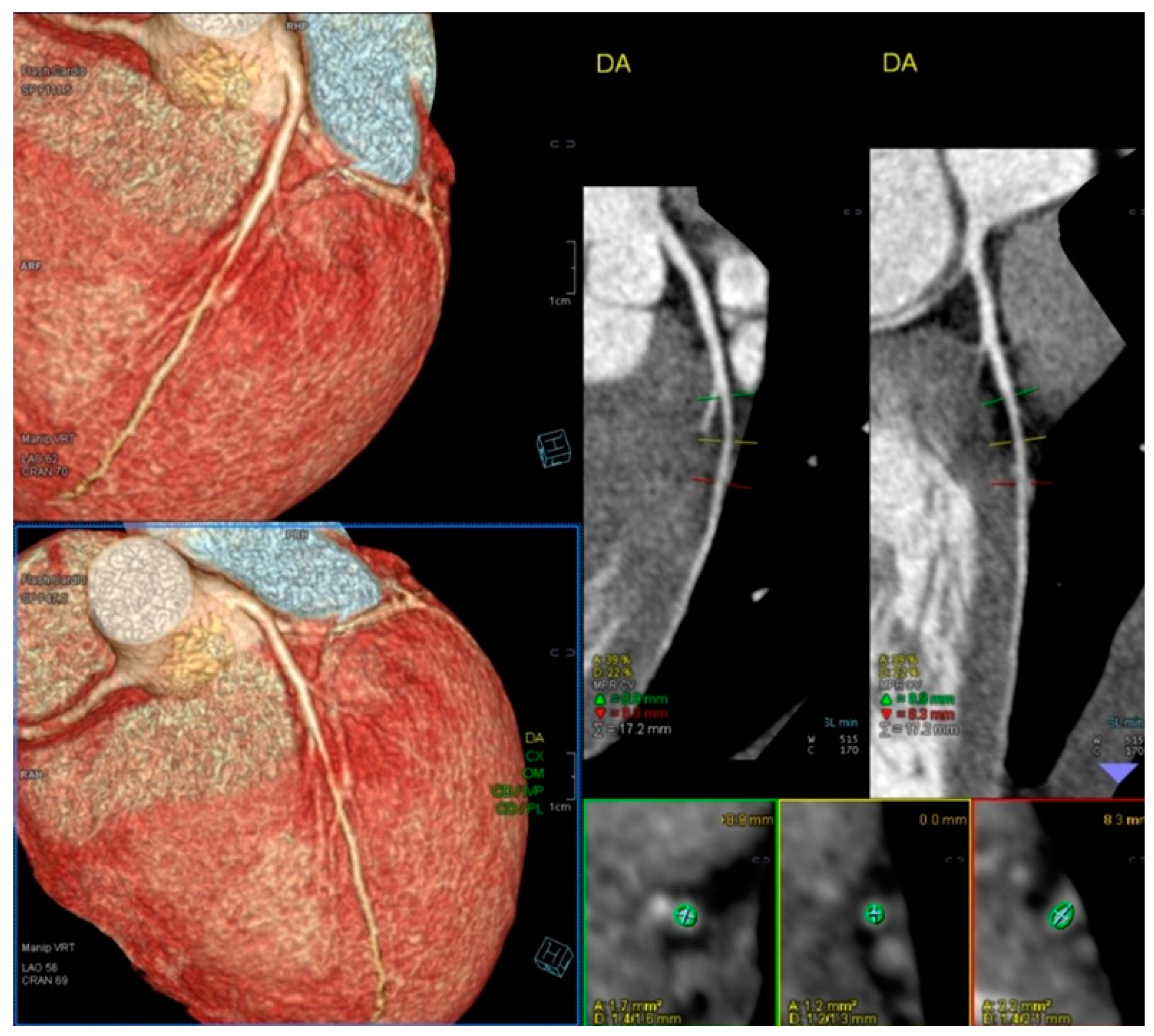 Jcm 13 02191 g004 Jcm 13 02191 g004