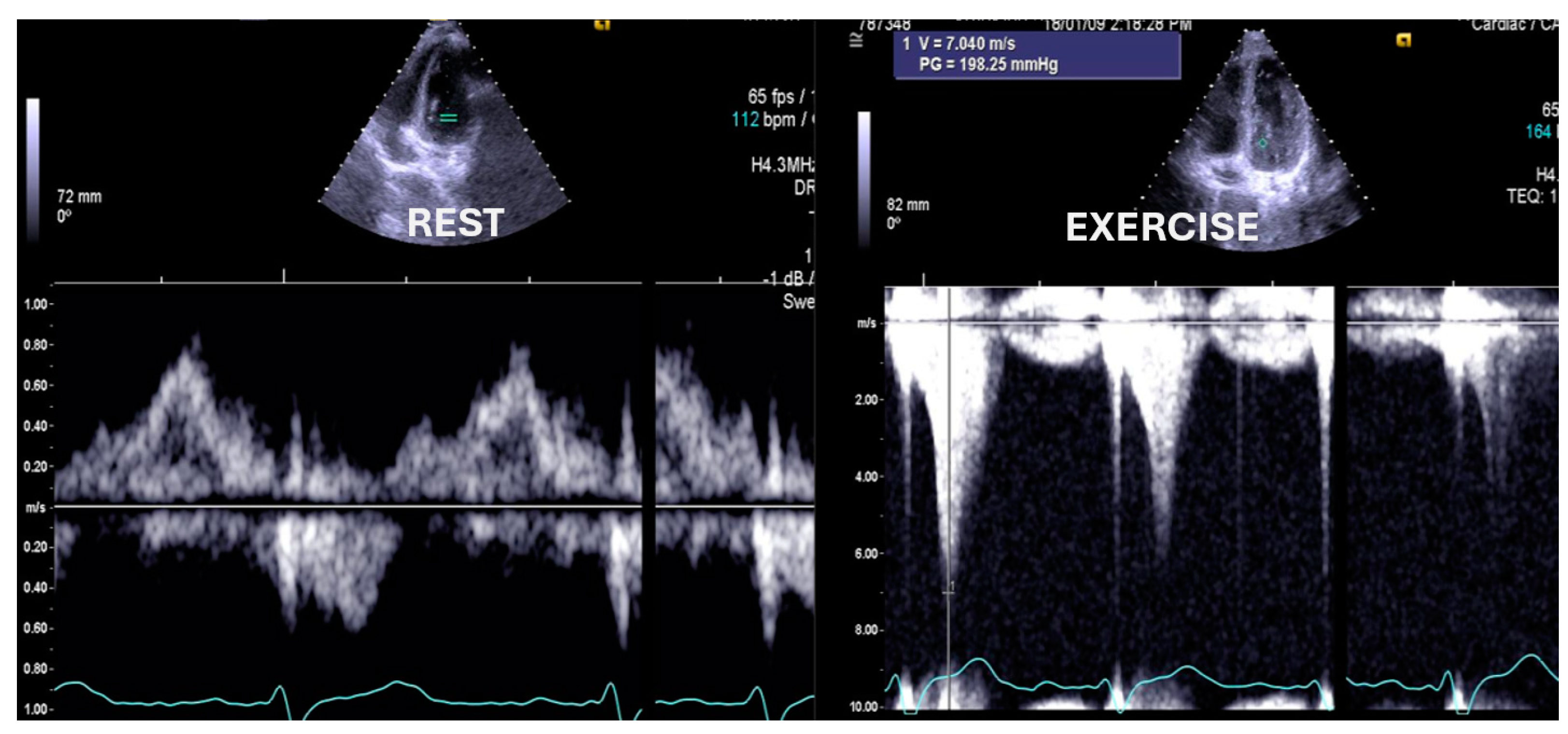 Jcm 13 02191 g005 Jcm 13 02191 g005