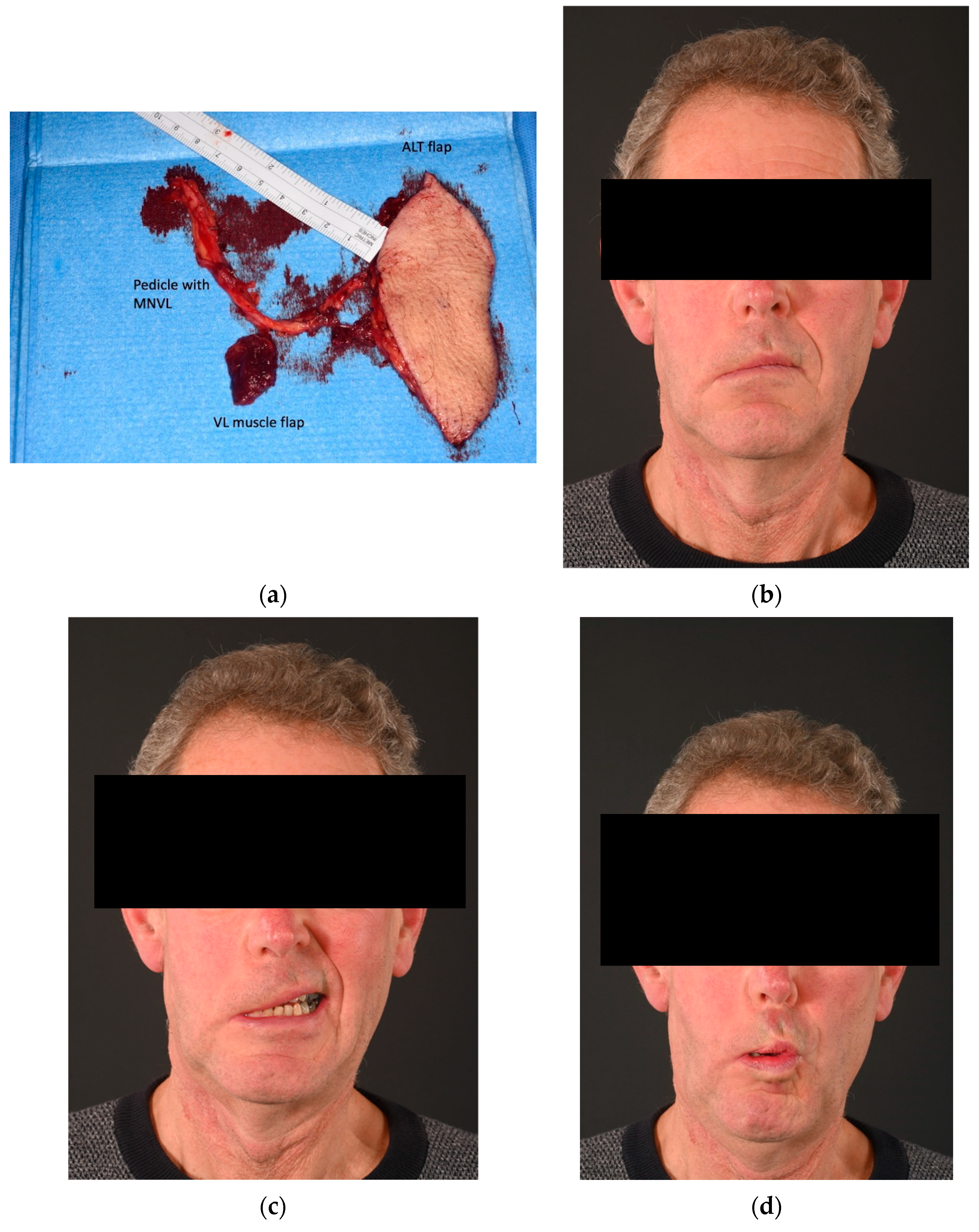 Jcm 13 02269 g007