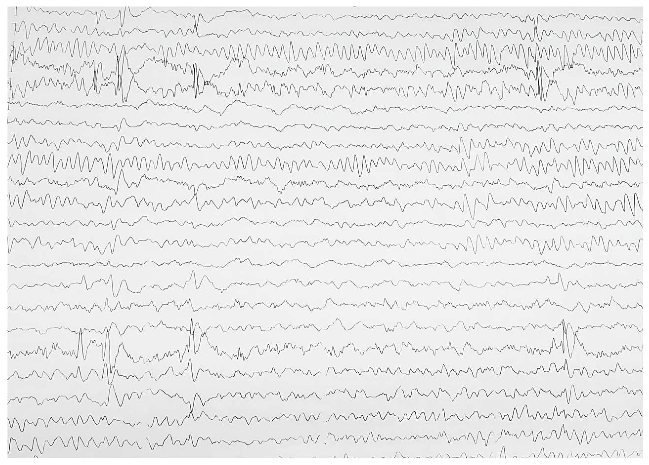 Jcm 13 02368 g004