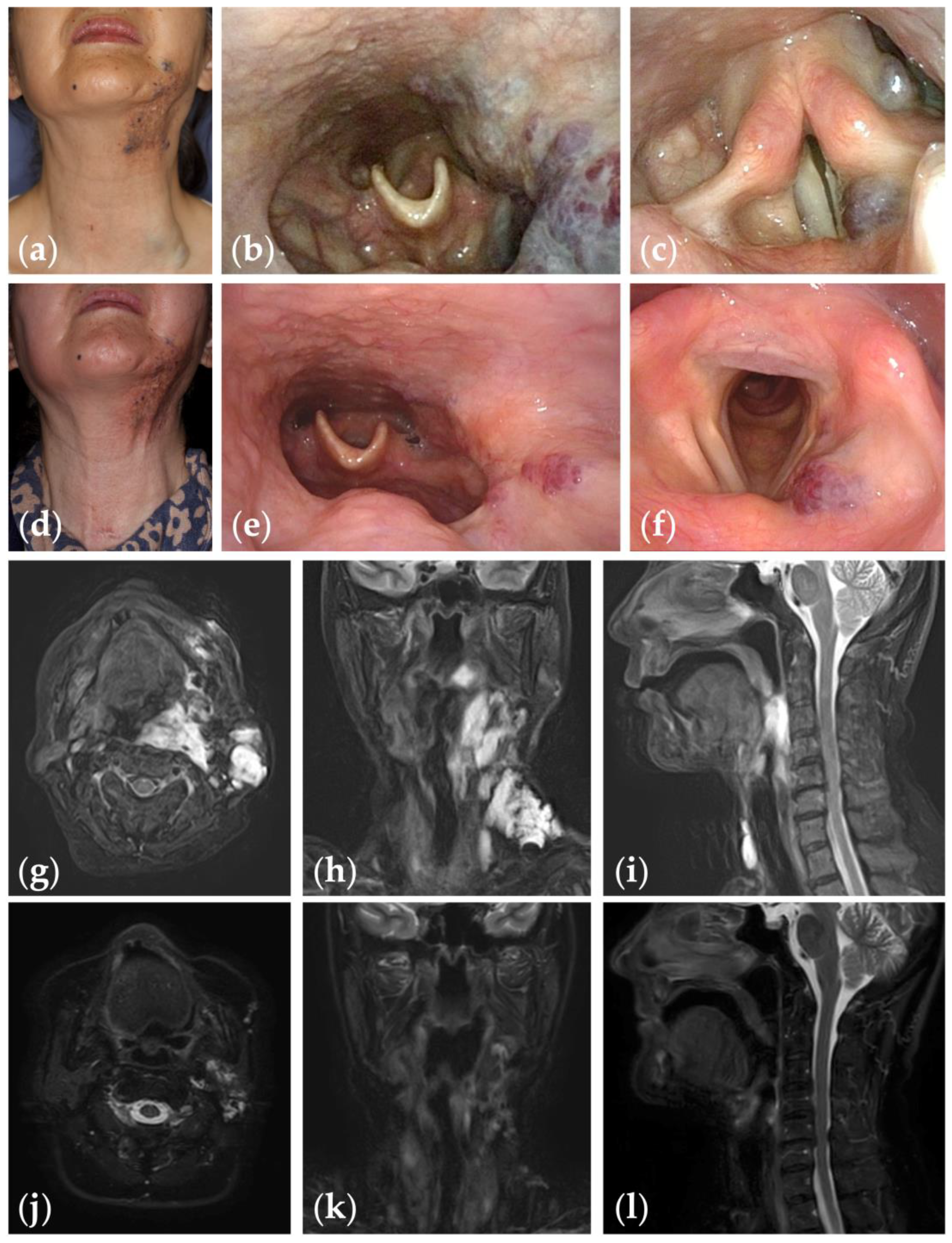 Jcm 13 02369 g002 Jcm 13 02369 g002