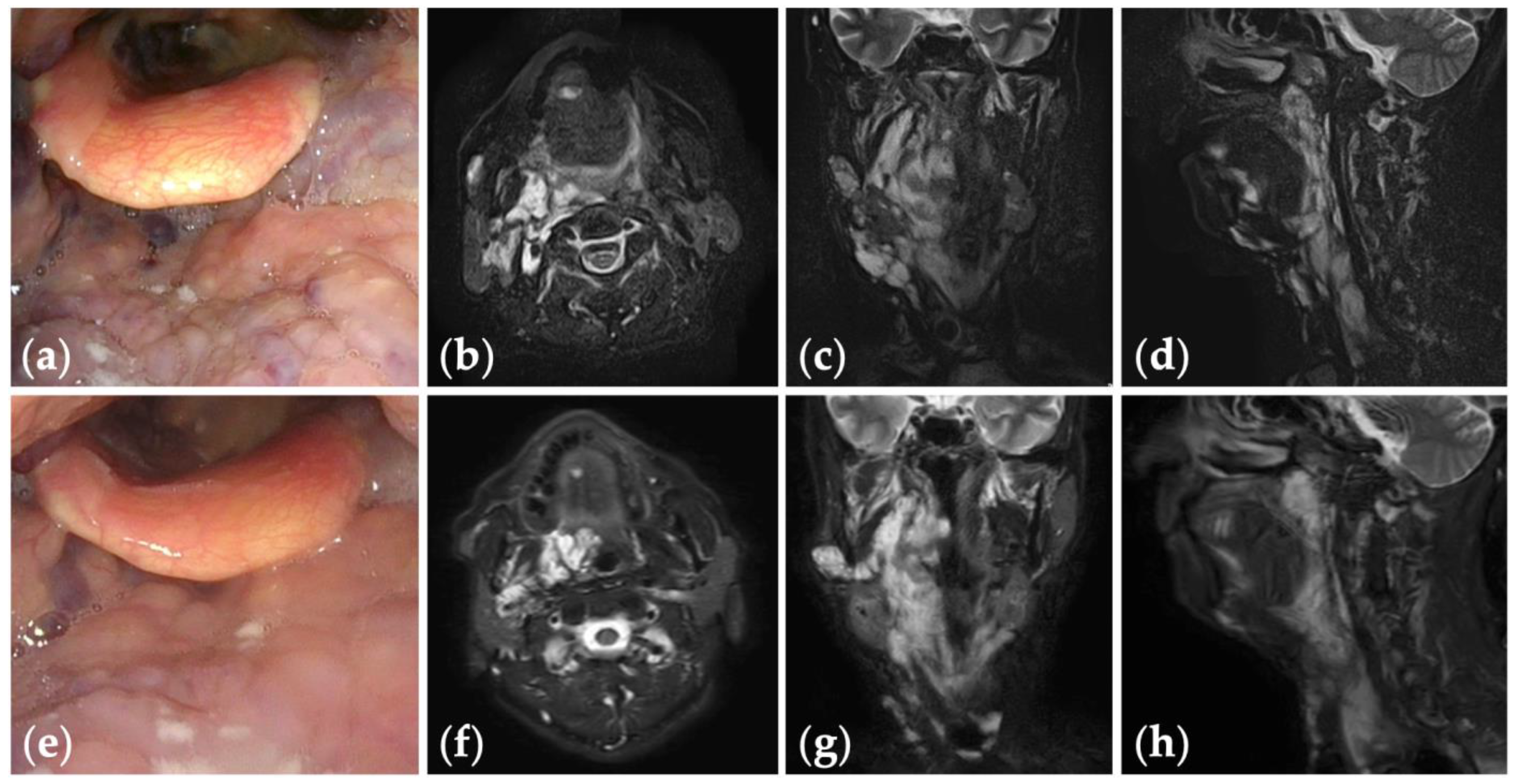 Jcm 13 02369 g003 Jcm 13 02369 g003