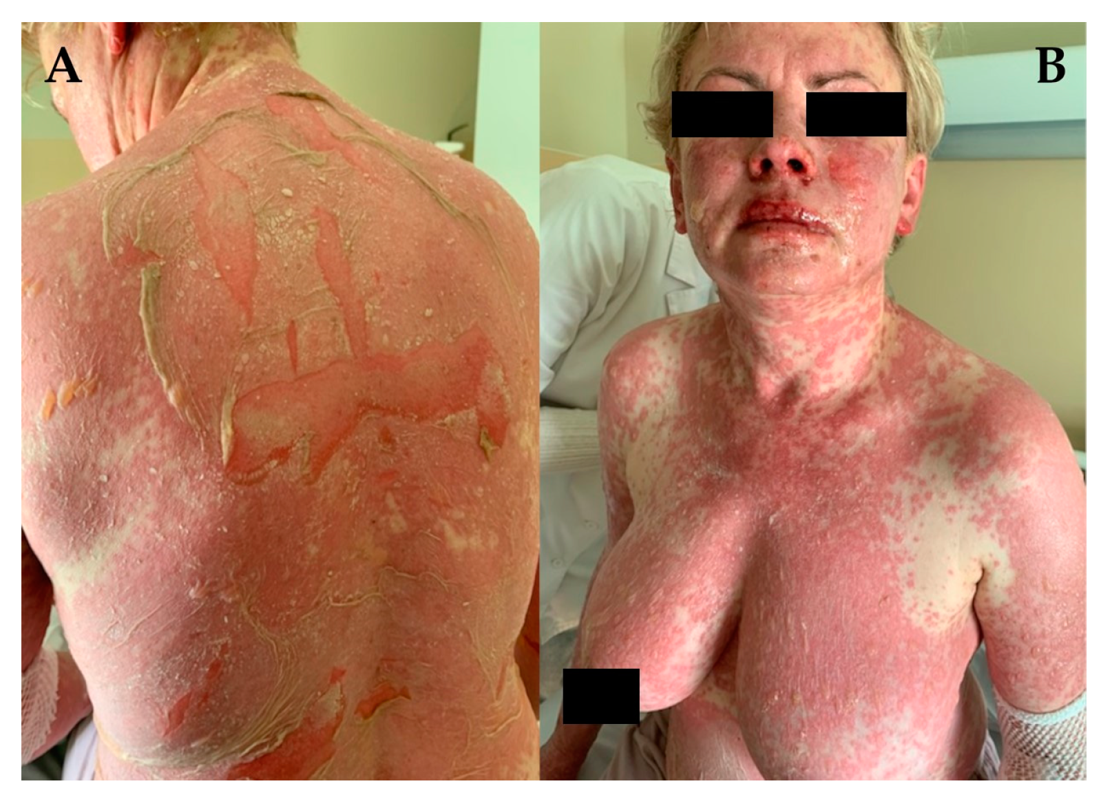 Jcm 13 02419 g001 Jcm 13 02419 g001