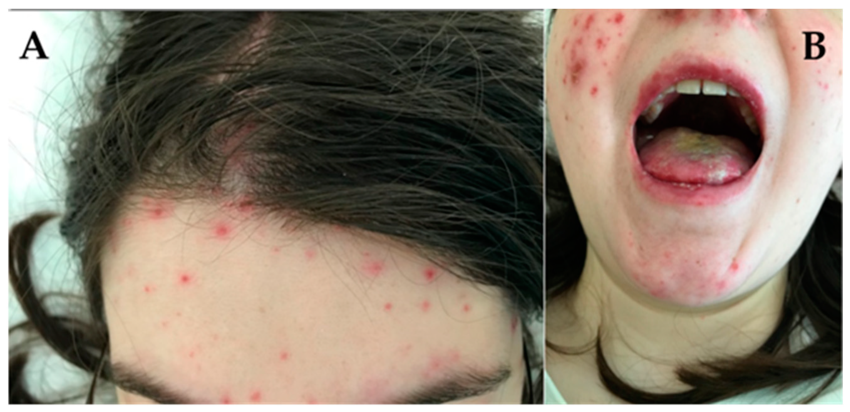 Jcm 13 02419 g002 Jcm 13 02419 g002