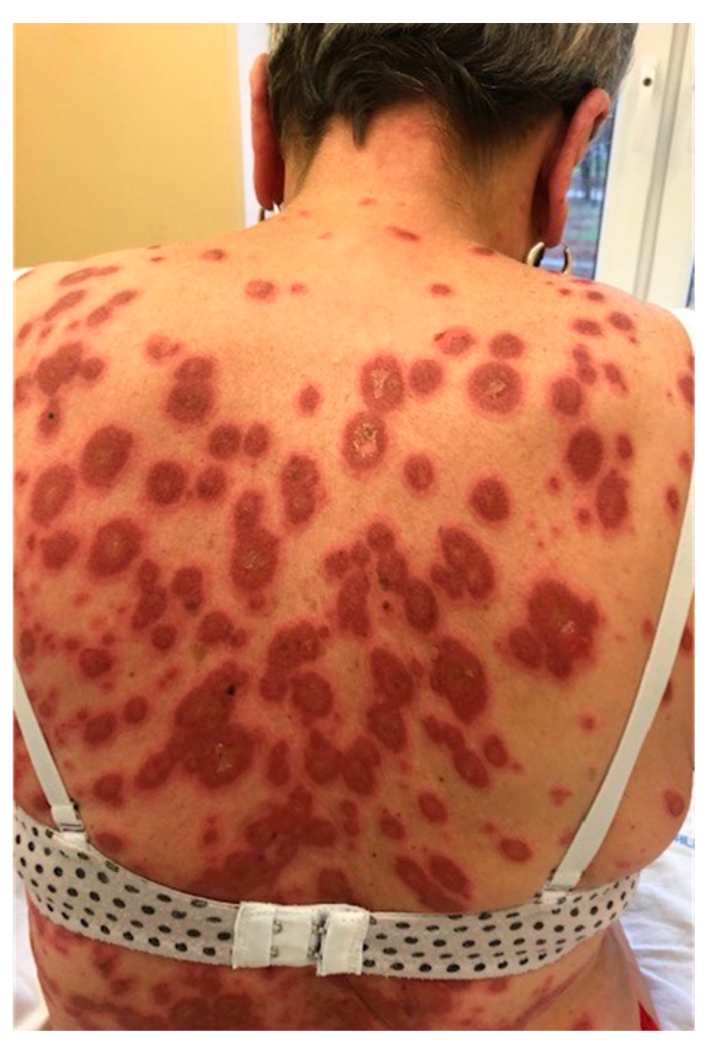 Jcm 13 02419 g003 Jcm 13 02419 g003