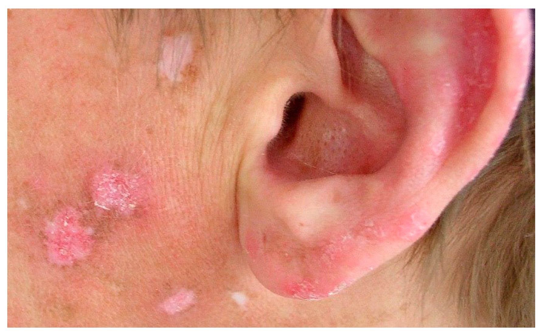 Jcm 13 02419 g005 Jcm 13 02419 g005