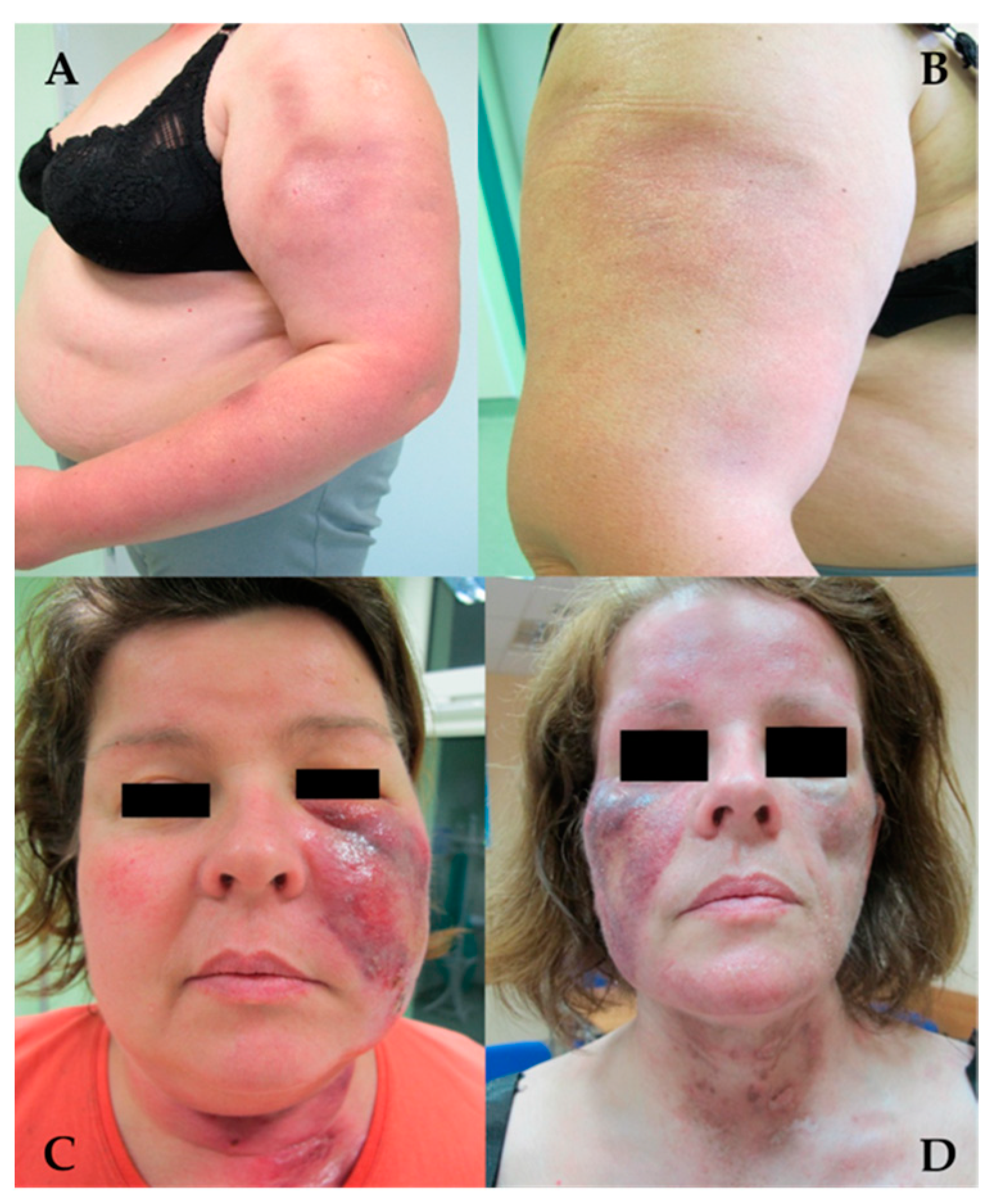 Jcm 13 02419 g006 Jcm 13 02419 g006