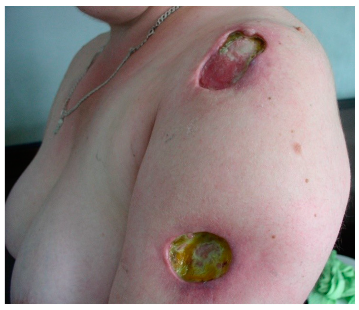 Jcm 13 02419 g007 Jcm 13 02419 g007