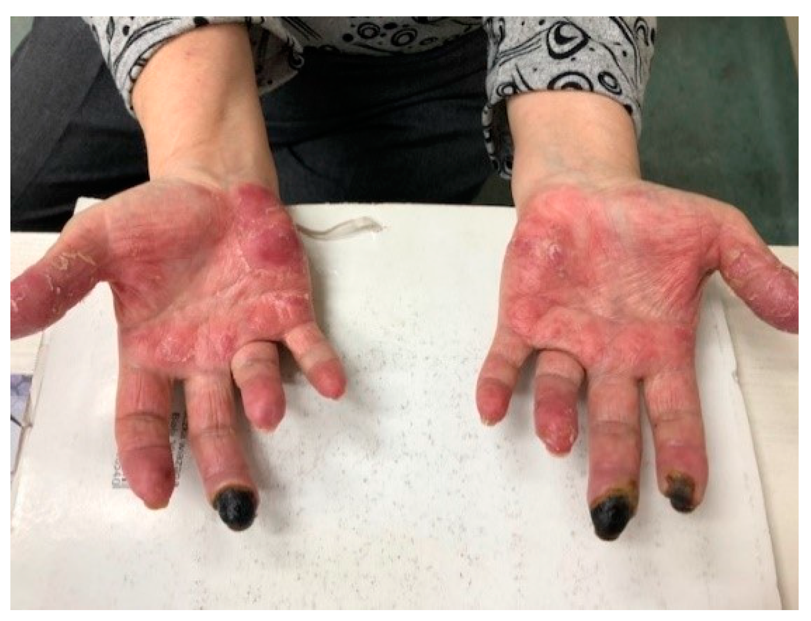 Jcm 13 02419 g008 Jcm 13 02419 g008