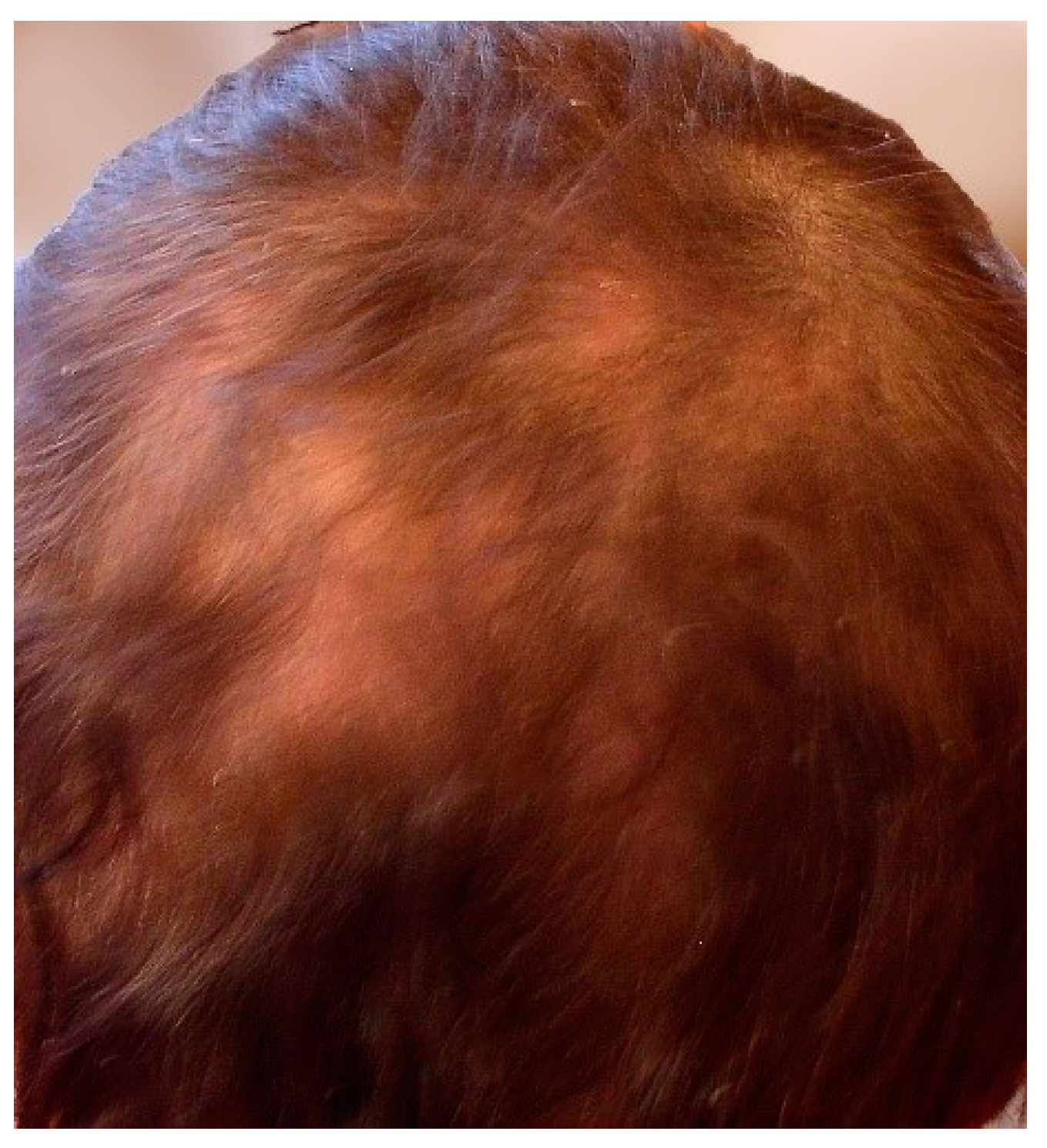 Jcm 13 02419 g010 Jcm 13 02419 g010