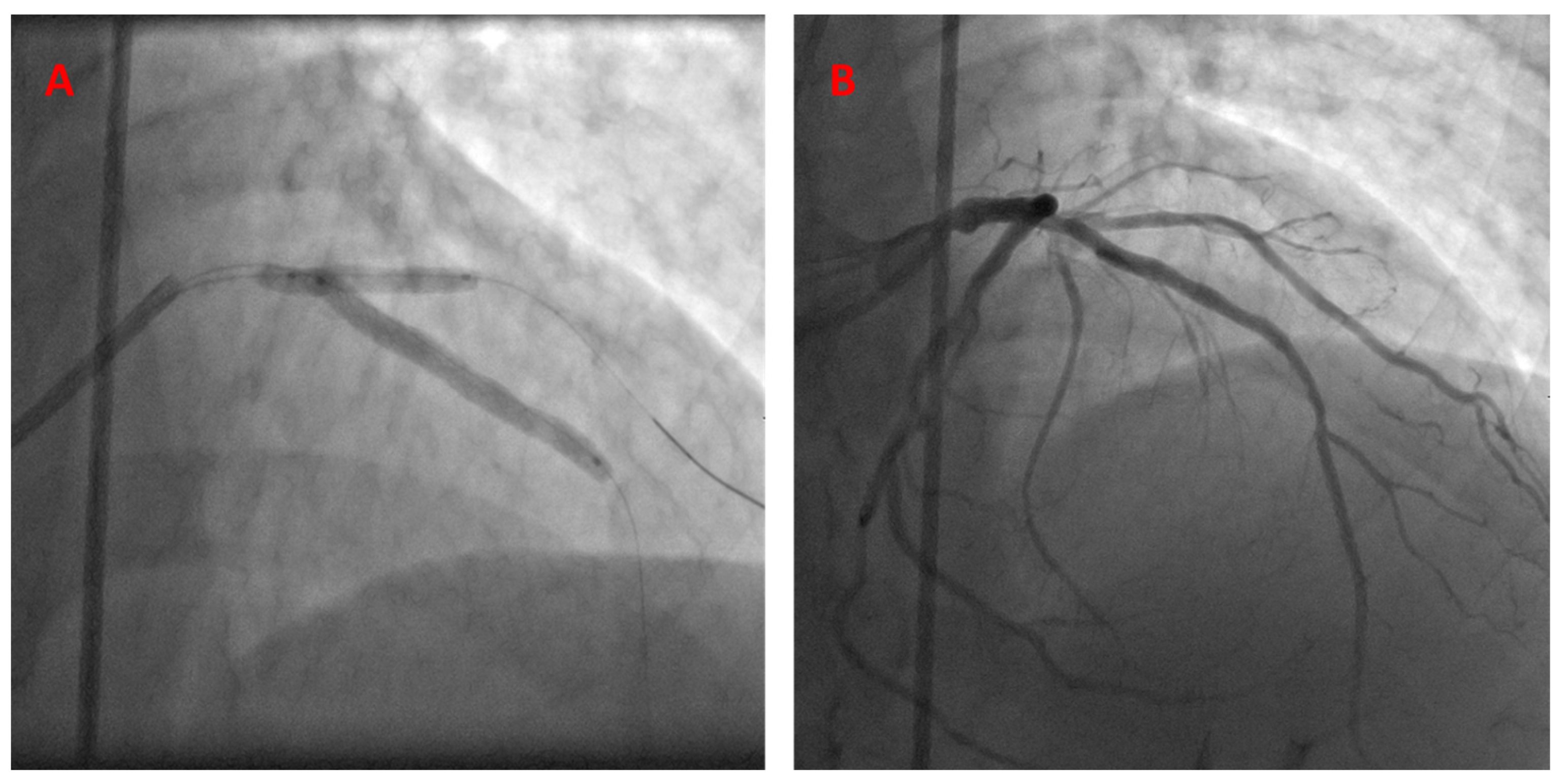 Jcm 13 02645 g003 Jcm 13 02645 g003
