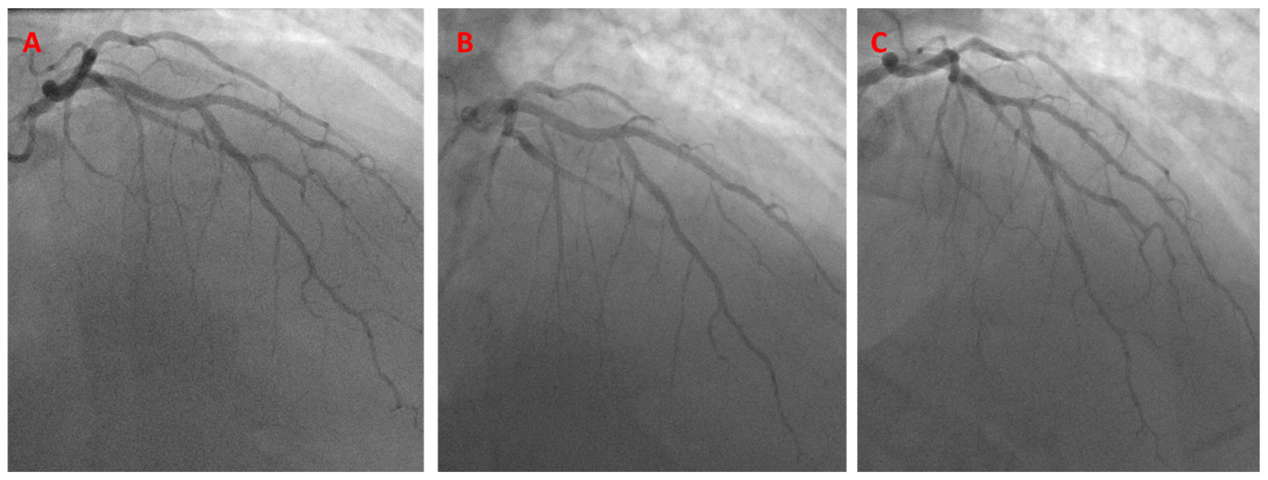 Jcm 13 02645 g009 Jcm 13 02645 g009