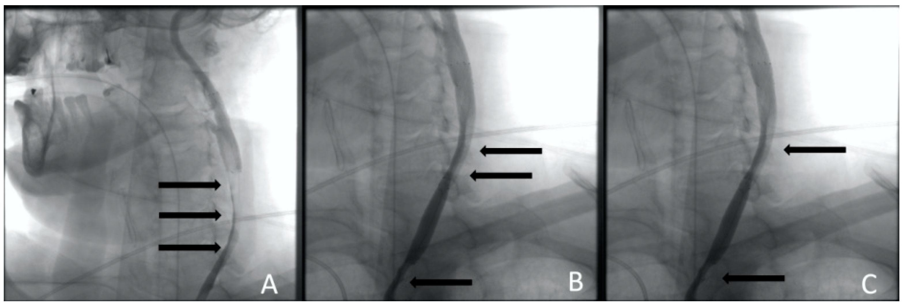 Jcm 13 02716 g005 Jcm 13 02716 g005