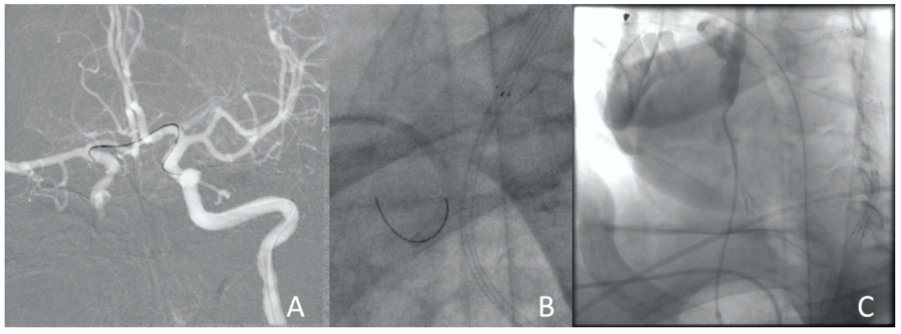 Jcm 13 02716 g006 Jcm 13 02716 g006