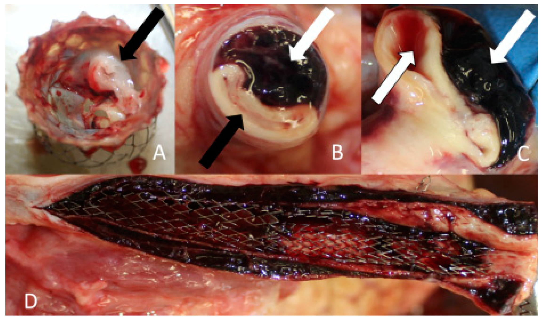 Jcm 13 02716 g008 Jcm 13 02716 g008