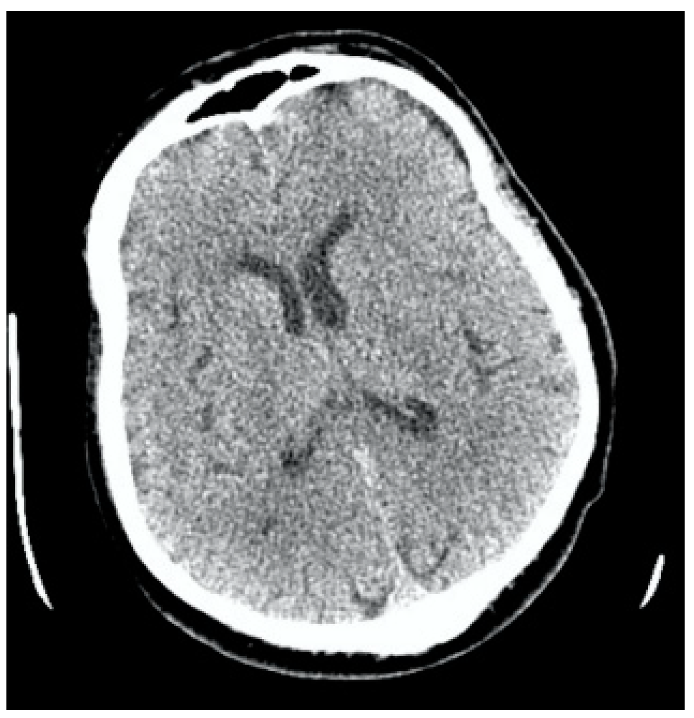 Jcm 13 02716 g009 Jcm 13 02716 g009