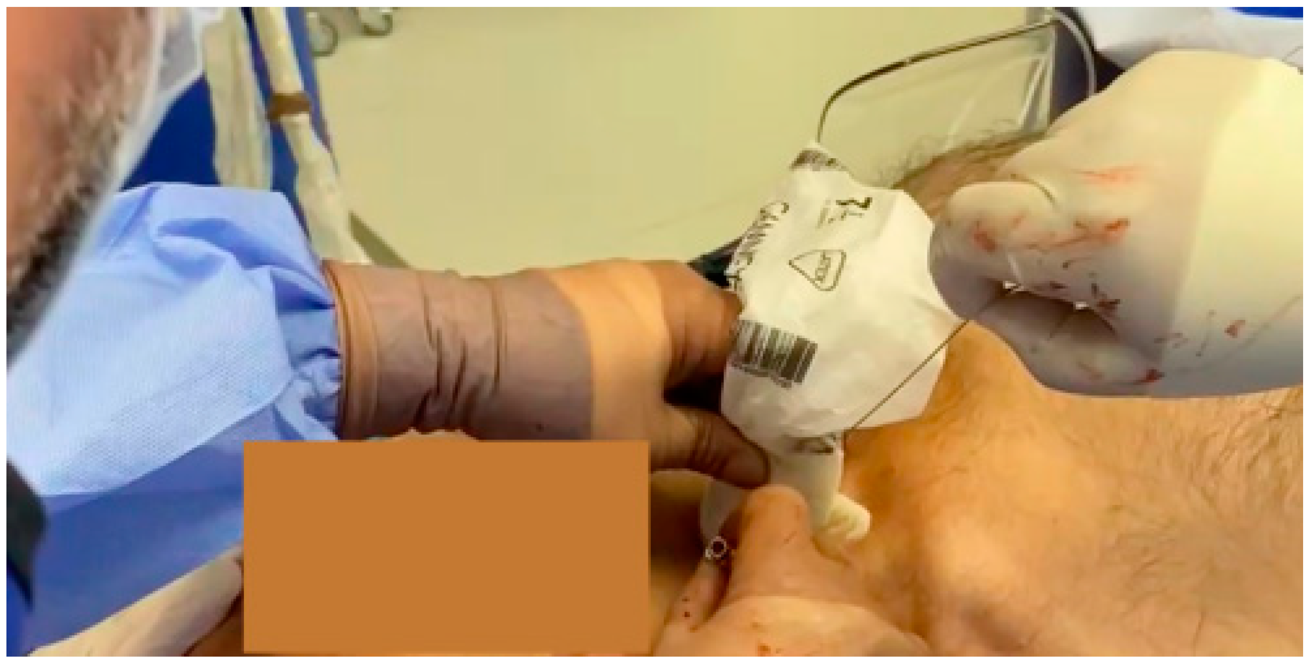 Jcm 13 02716 g012 Jcm 13 02716 g012