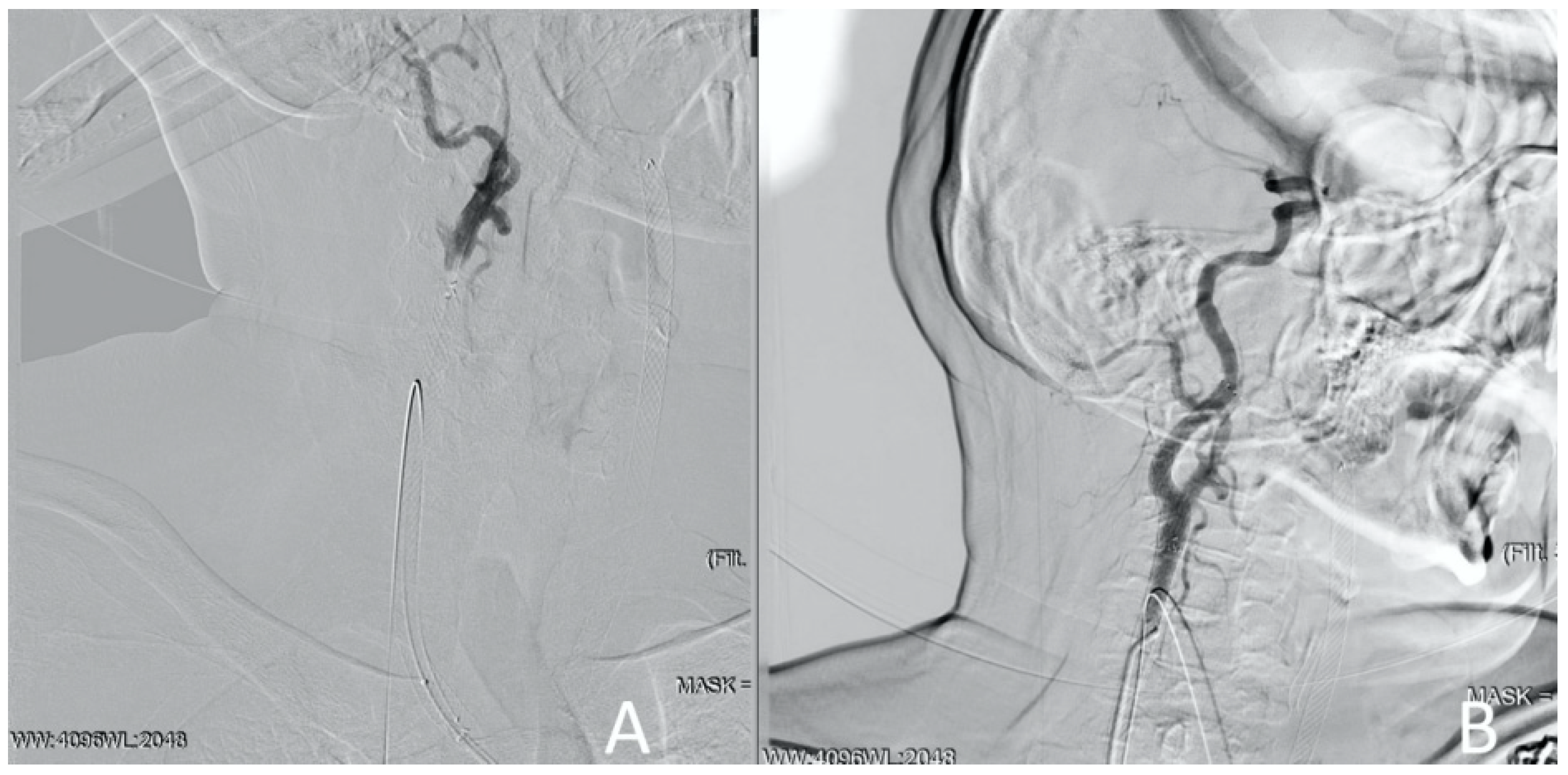 Jcm 13 02716 g013 Jcm 13 02716 g013