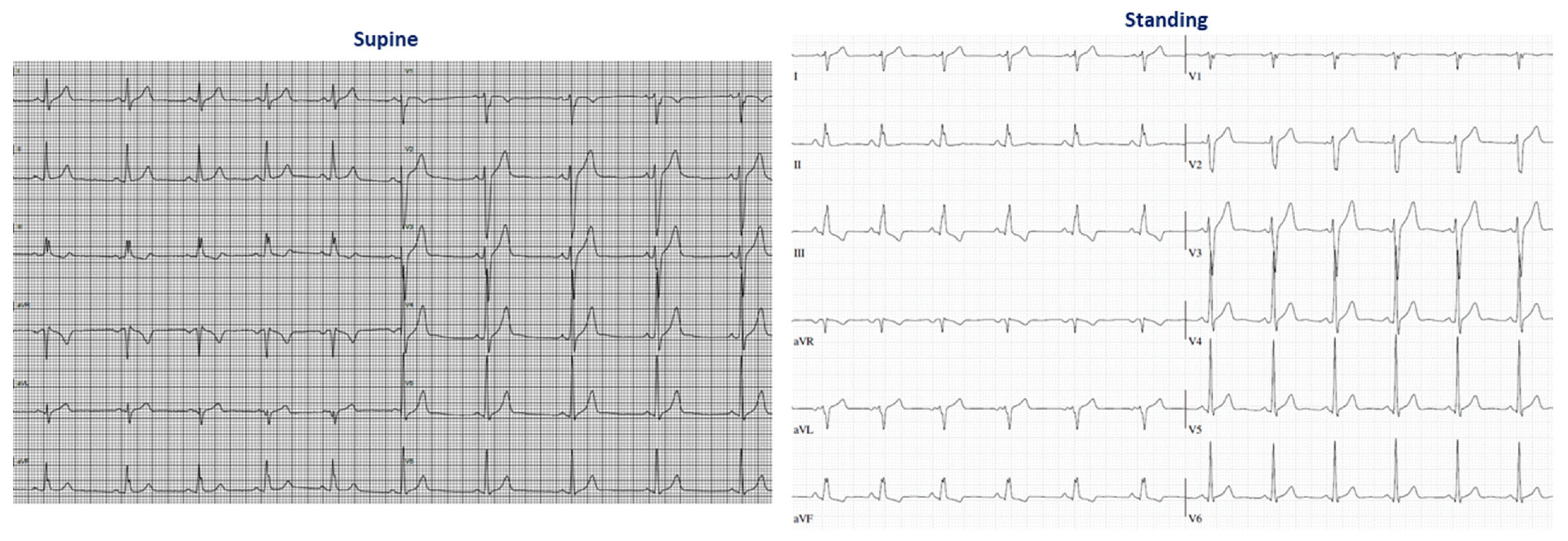 Jcm 13 02741 g004 Jcm 13 02741 g004