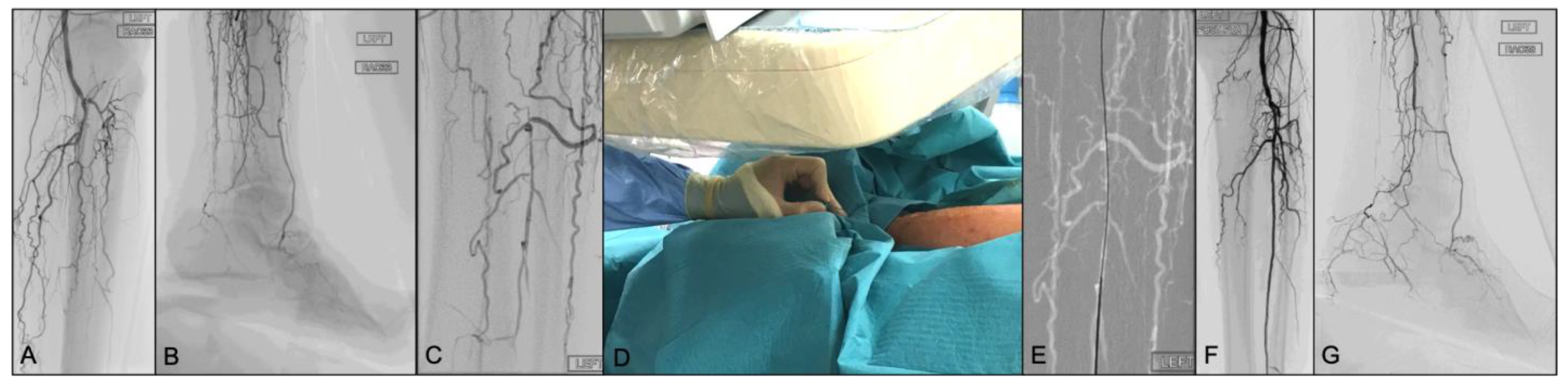 Jcm 13 02770 g001 Jcm 13 02770 g001