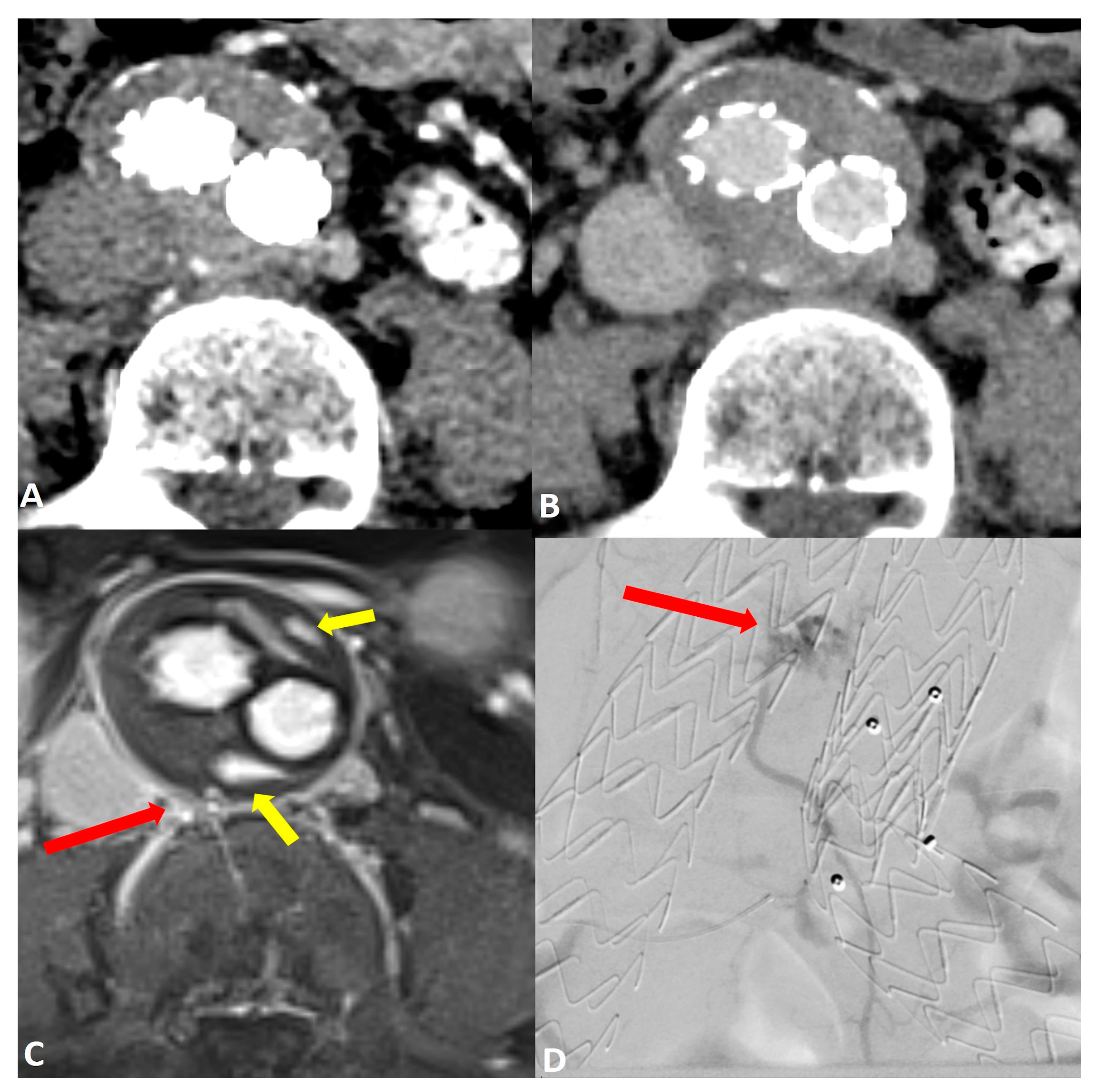 Jcm 13 02913 g002 Jcm 13 02913 g002